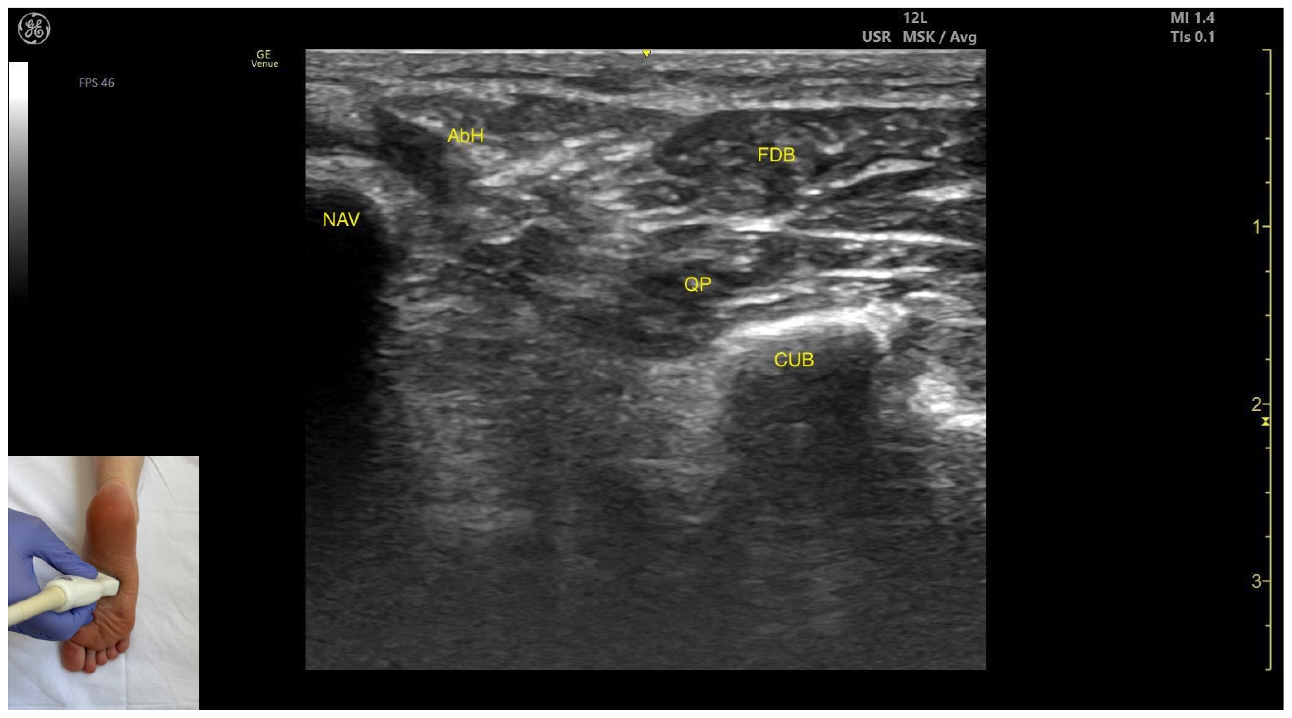 Toxins 17 00508 g011 Toxins 17 00508 g011