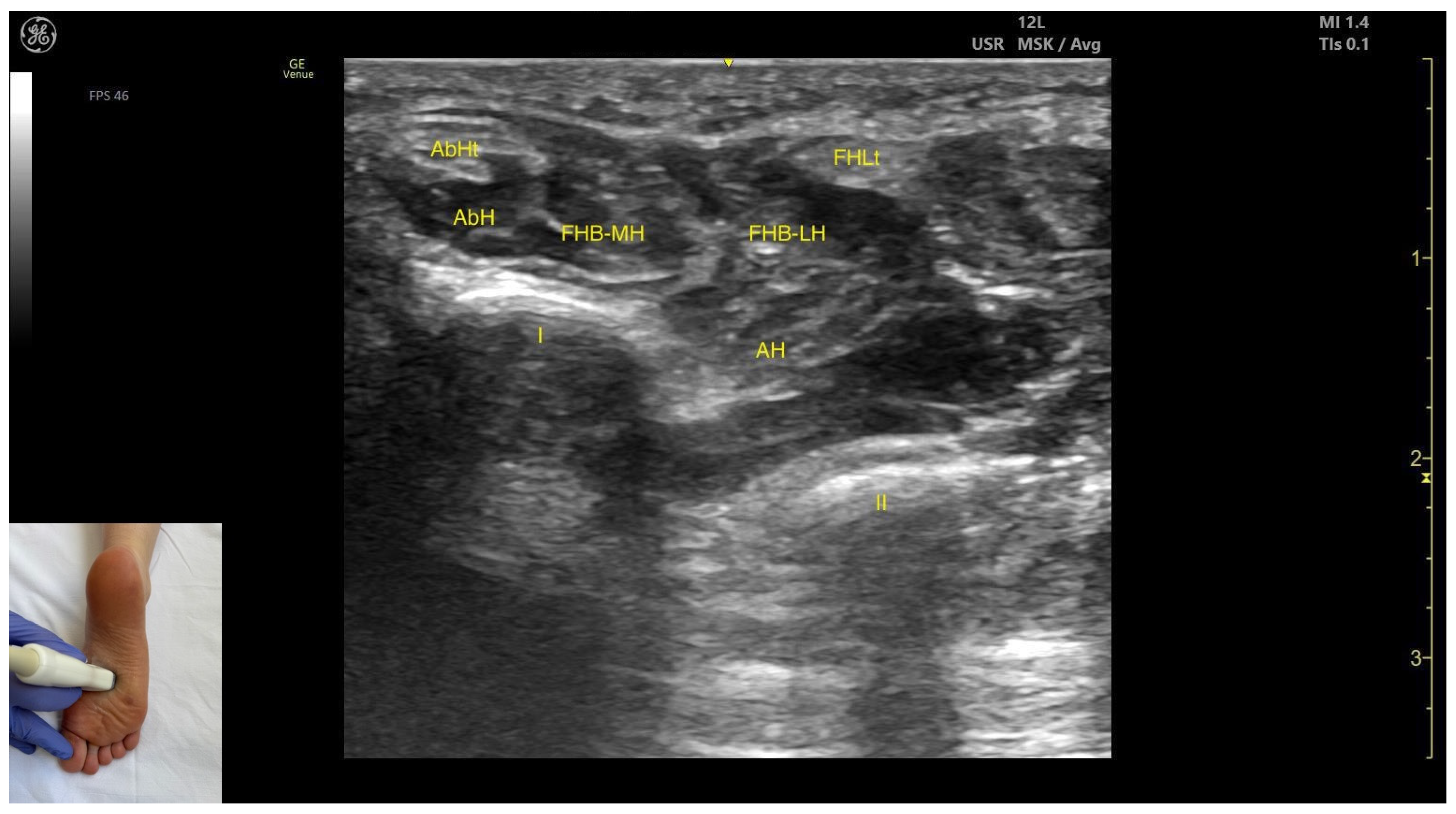 Toxins 17 00508 g012 Toxins 17 00508 g012
