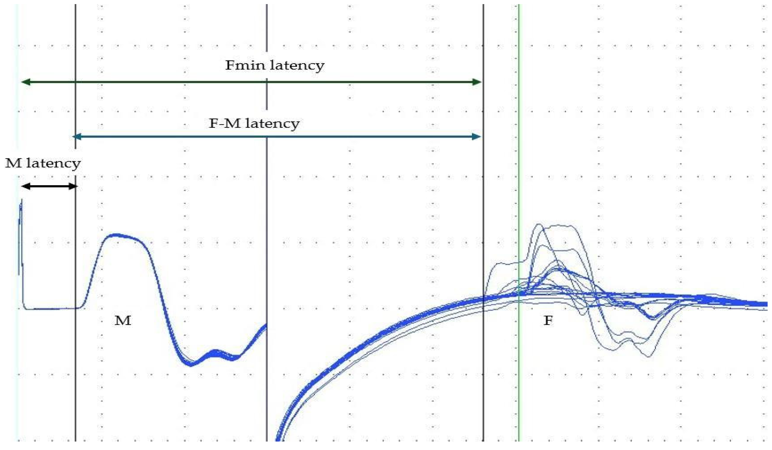 Toxins 18 00021 g001 Toxins 18 00021 g001
