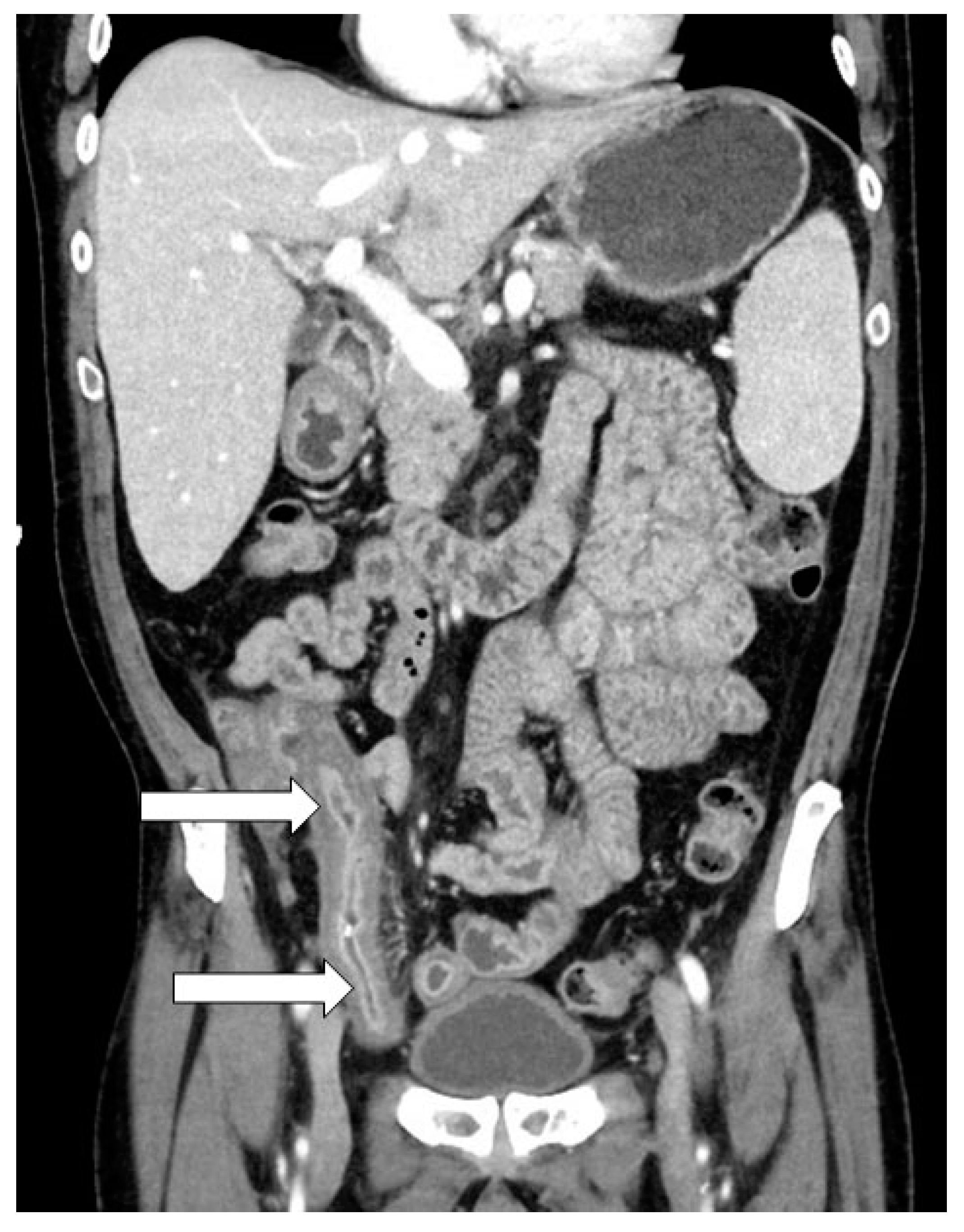 Transplantology 01 00010 g003