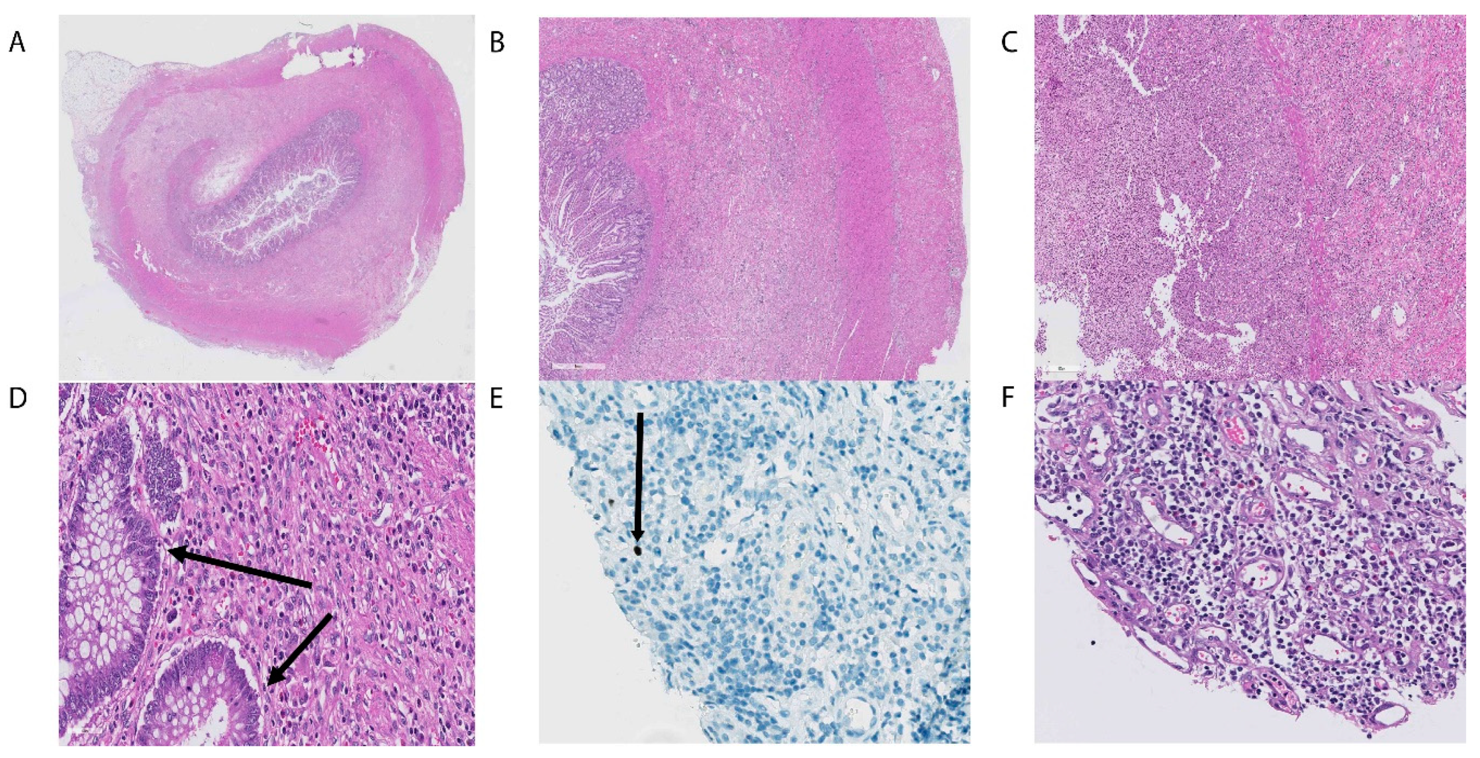 Transplantology 01 00010 g004