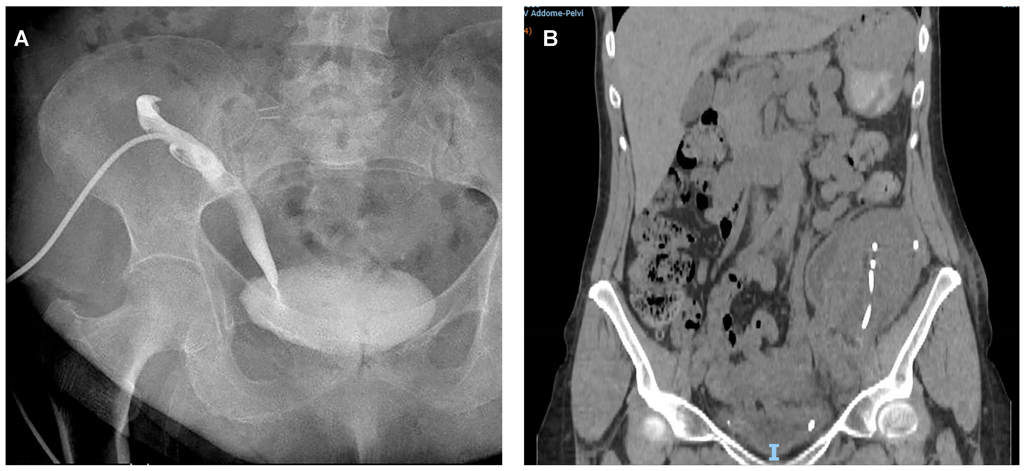 Transplantology 02 00003 g001