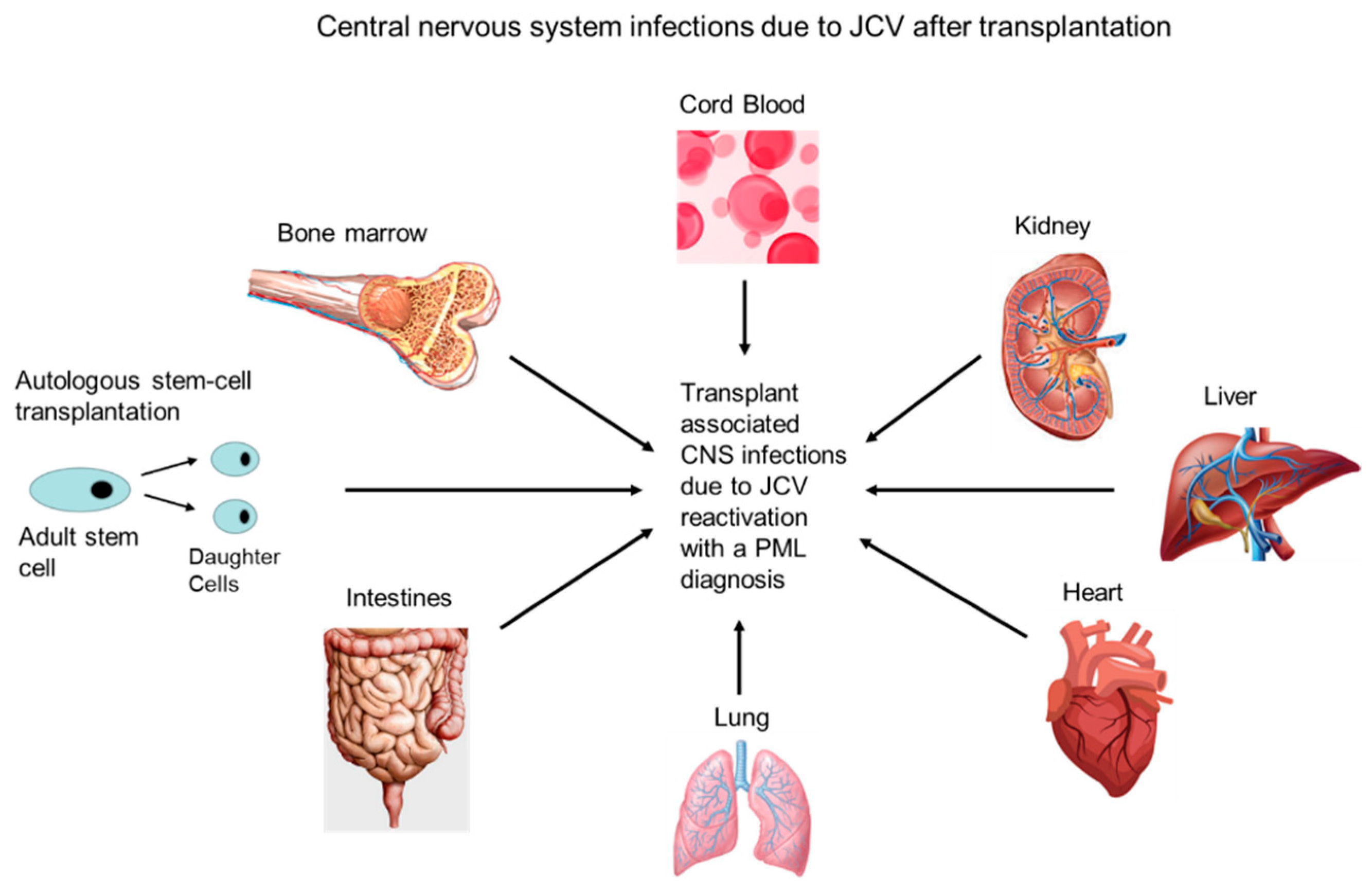 Transplantology 02 00004 g002 Transplantology 02 00004 g002
