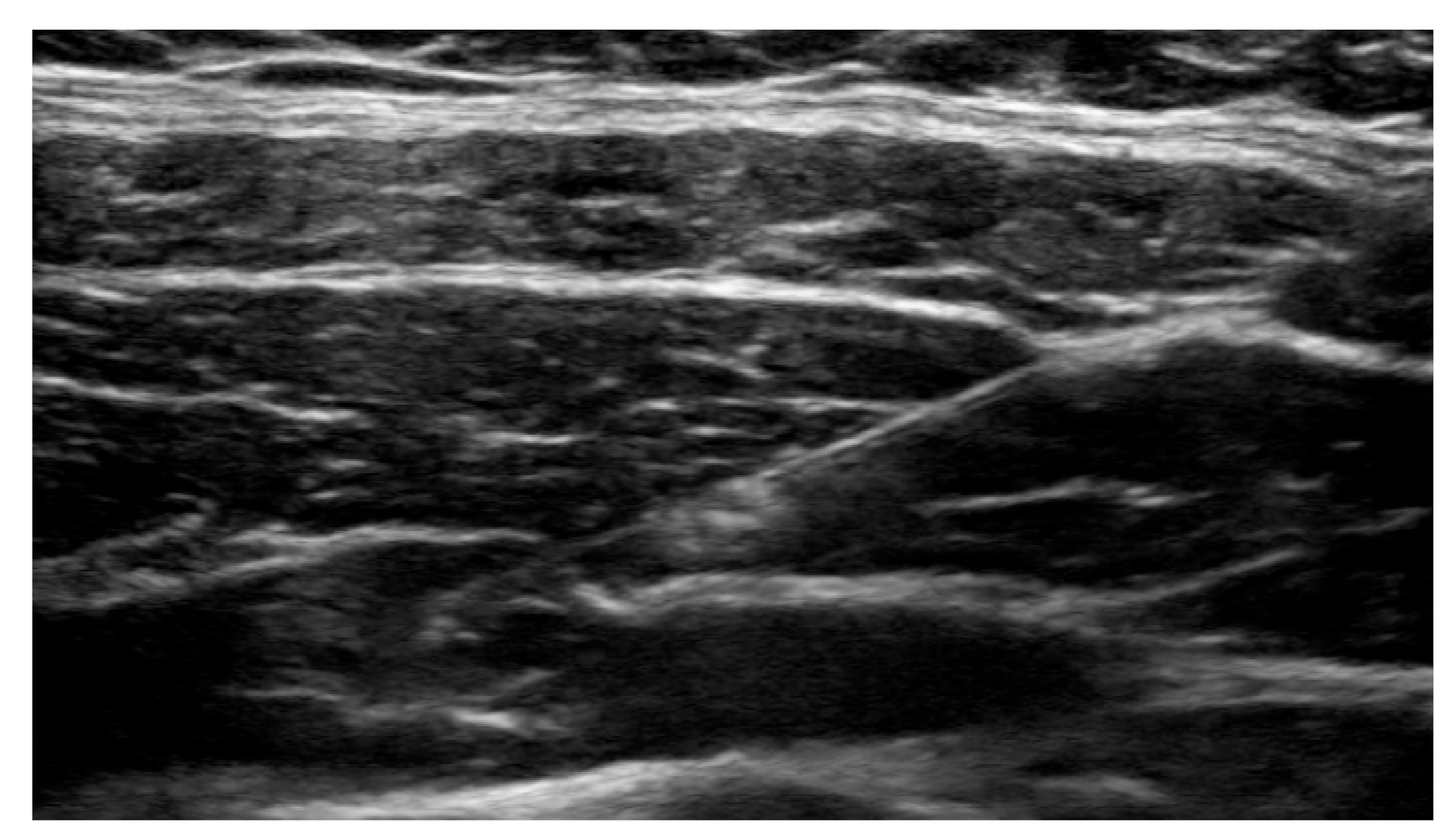 Transplantology 02 00006 g001