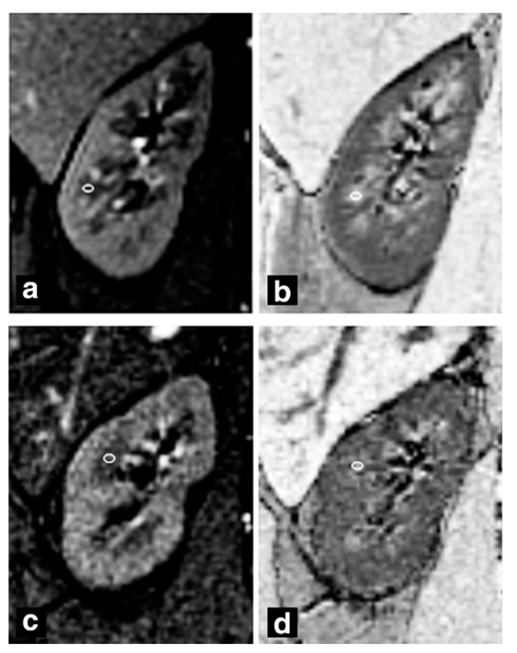 Transplantology 02 00011 g002