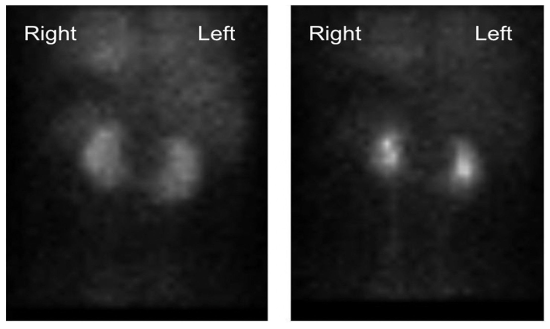 Transplantology Free FullText Laparoscopic LivingDonor