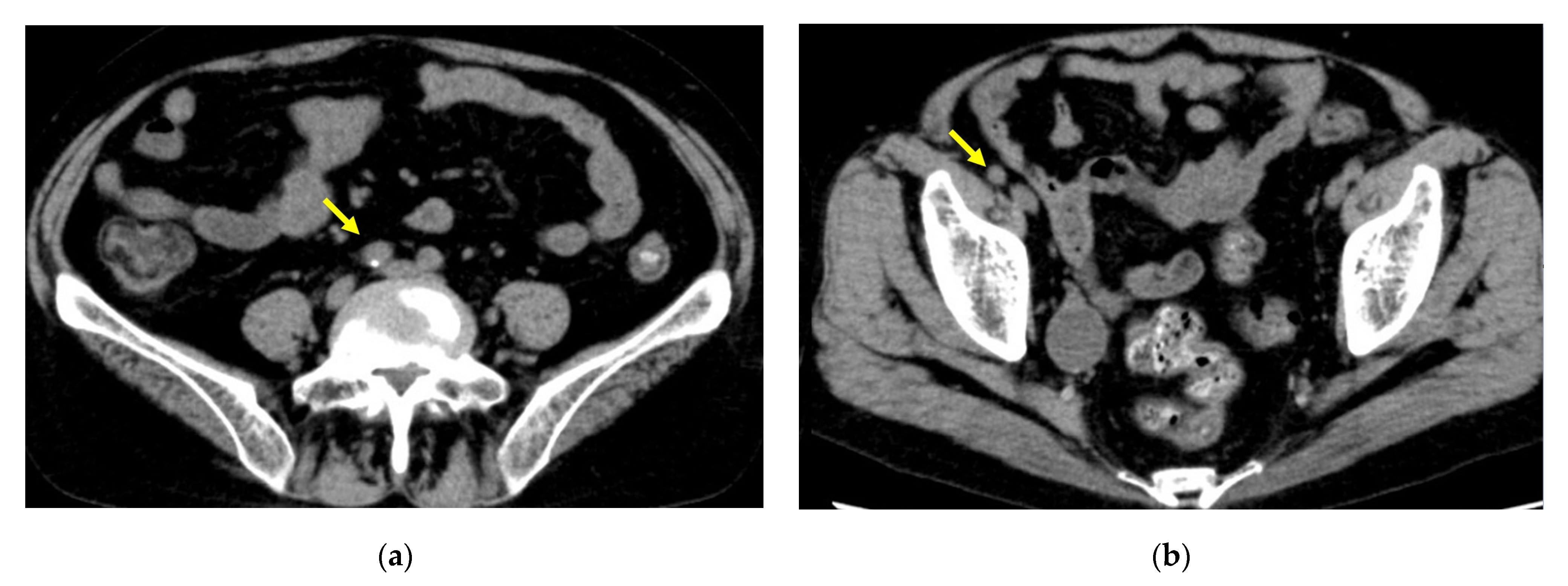 Transplantology 03 00001 g001