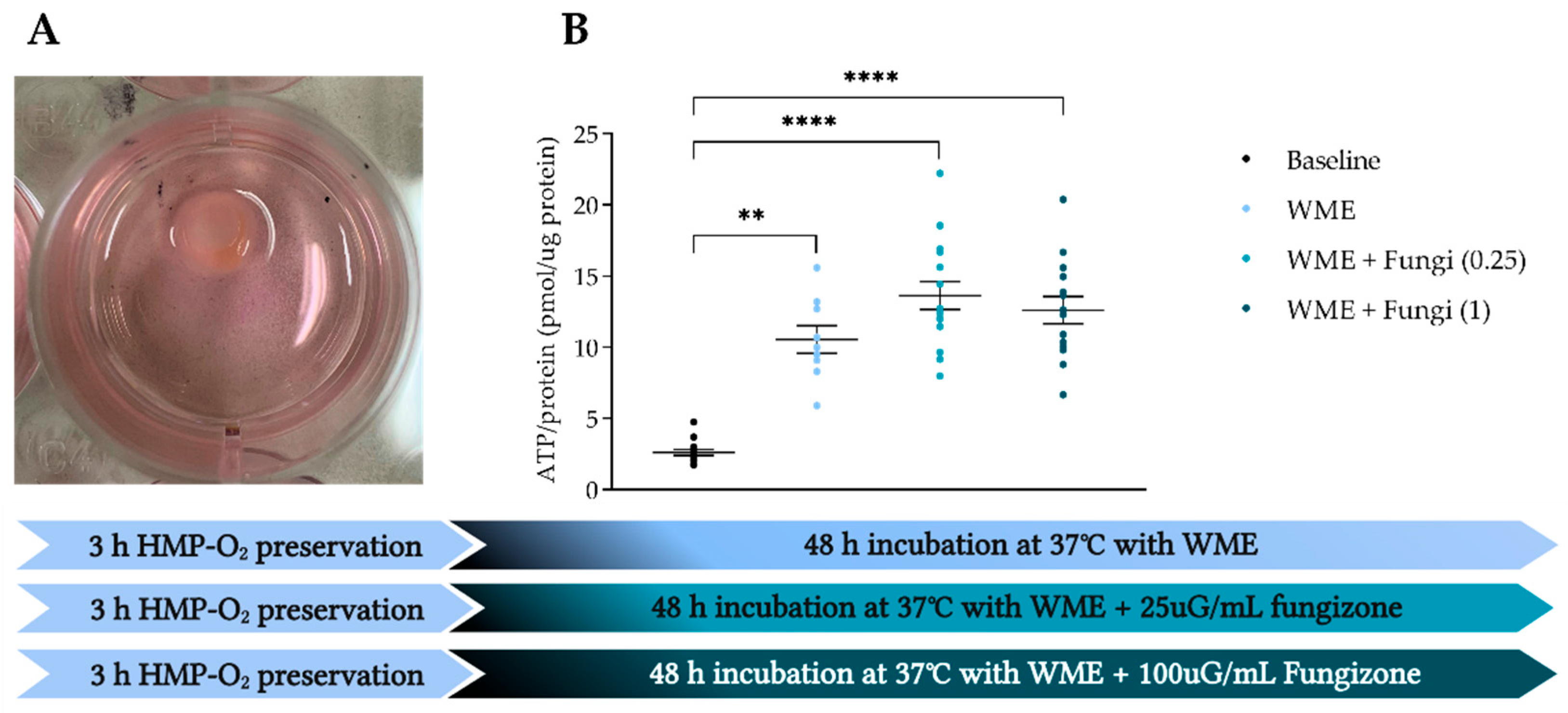 Transplantology 03 00015 g006