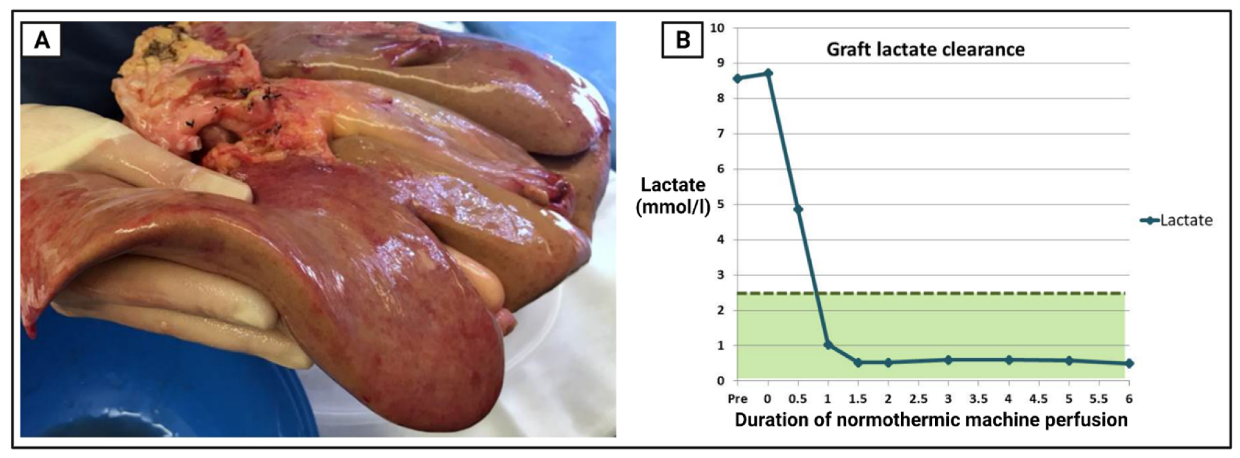 Transplantology 03 00018 g001