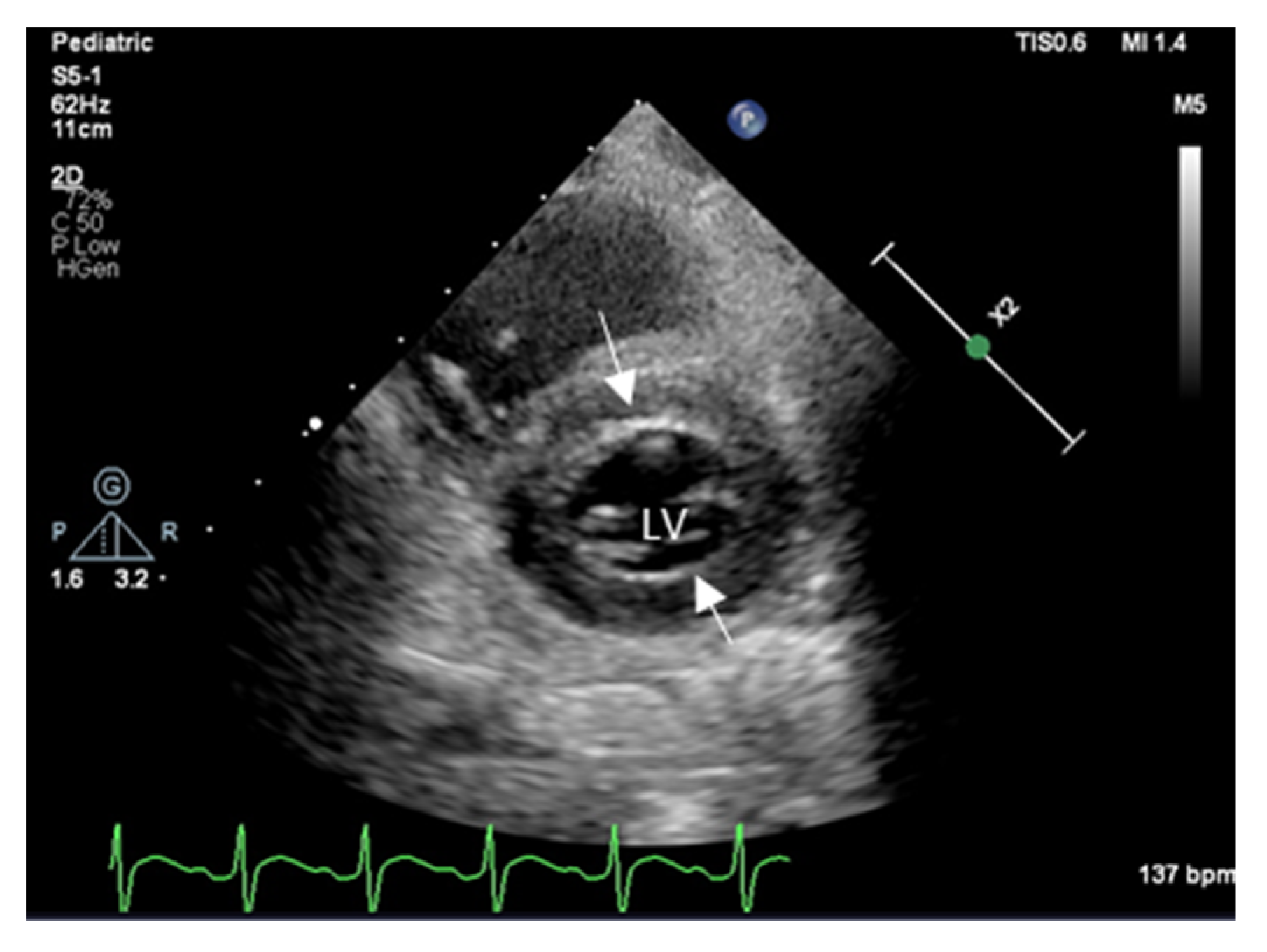 Transplantology 03 00025 g001