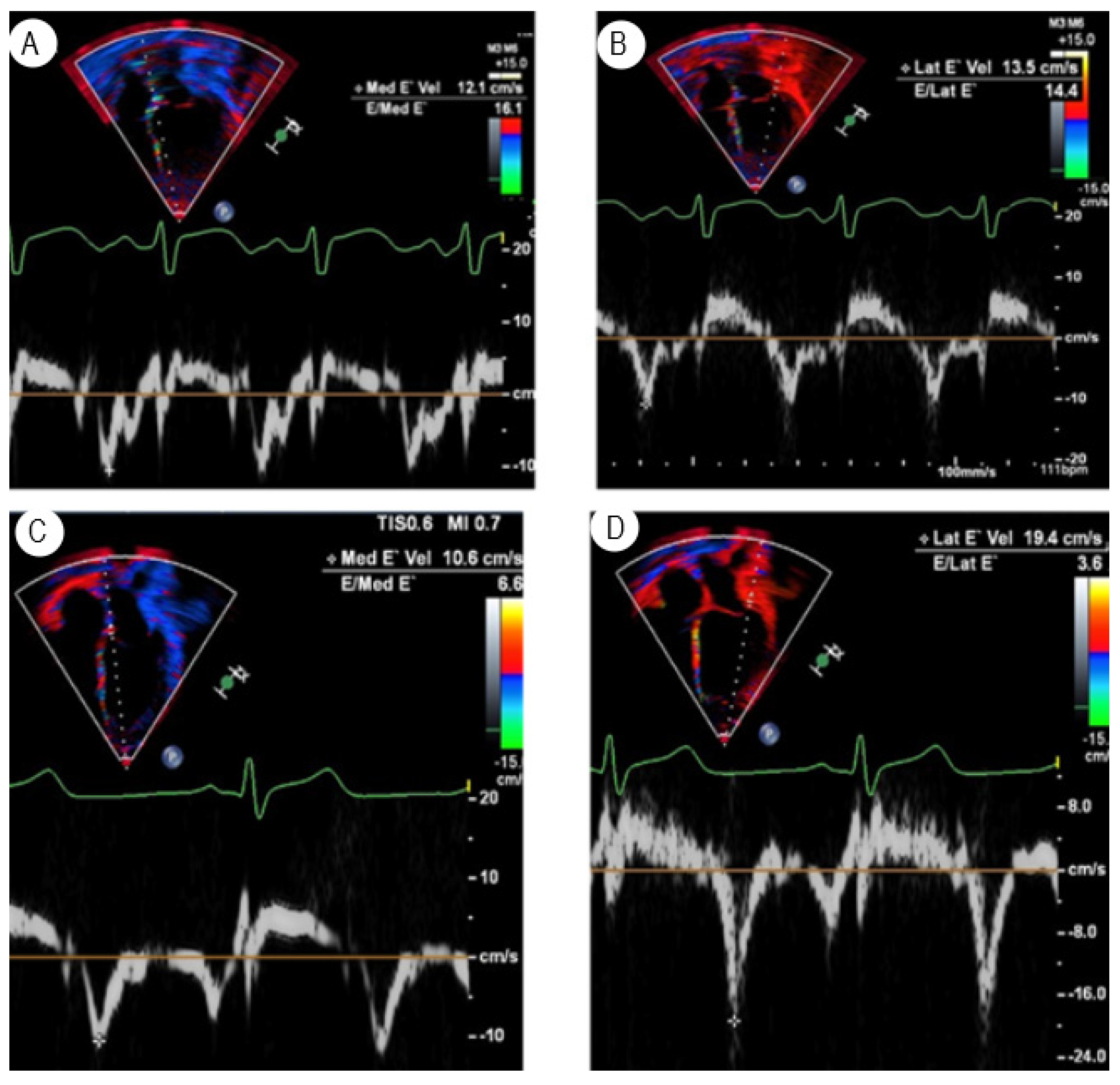 Transplantology 03 00025 g002
