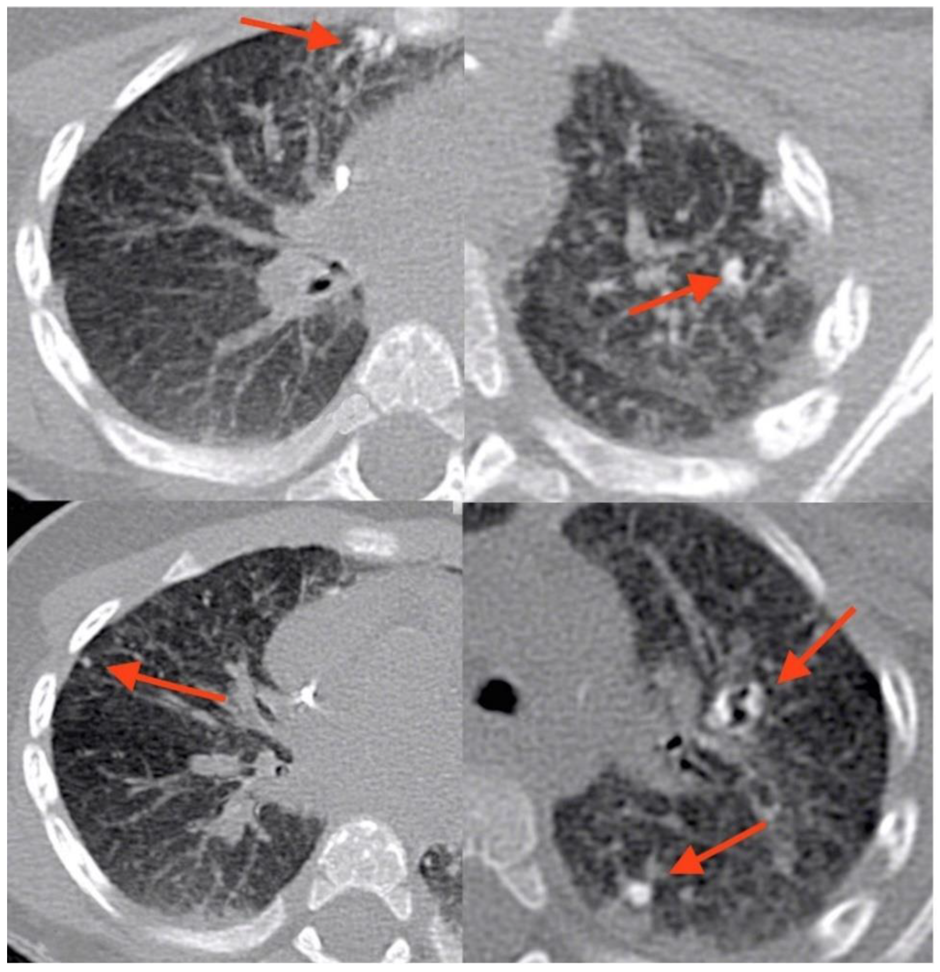 Transplantology 03 00029 g002