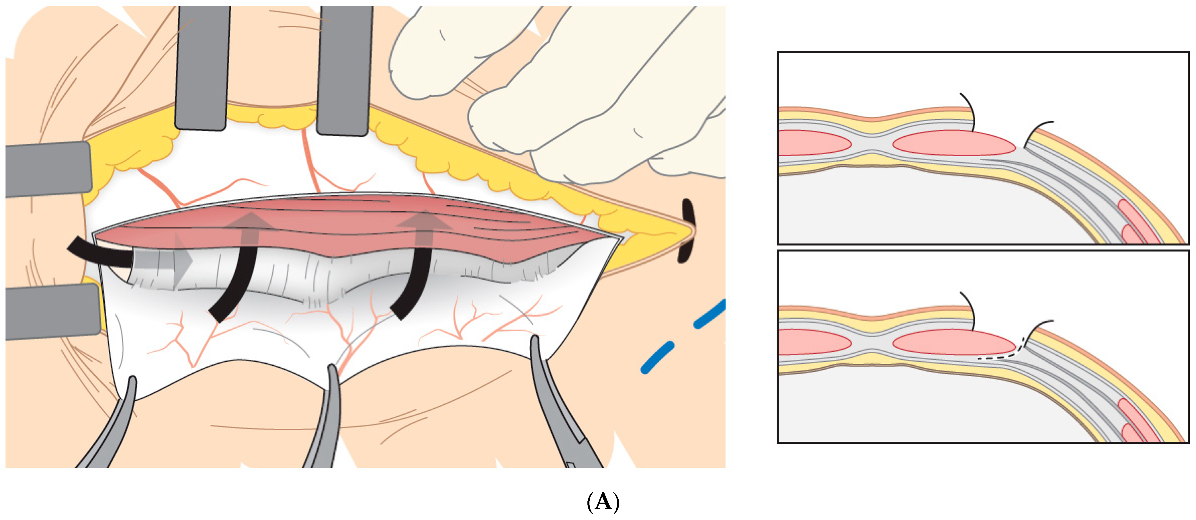 Transplantology 04 00001 g001a