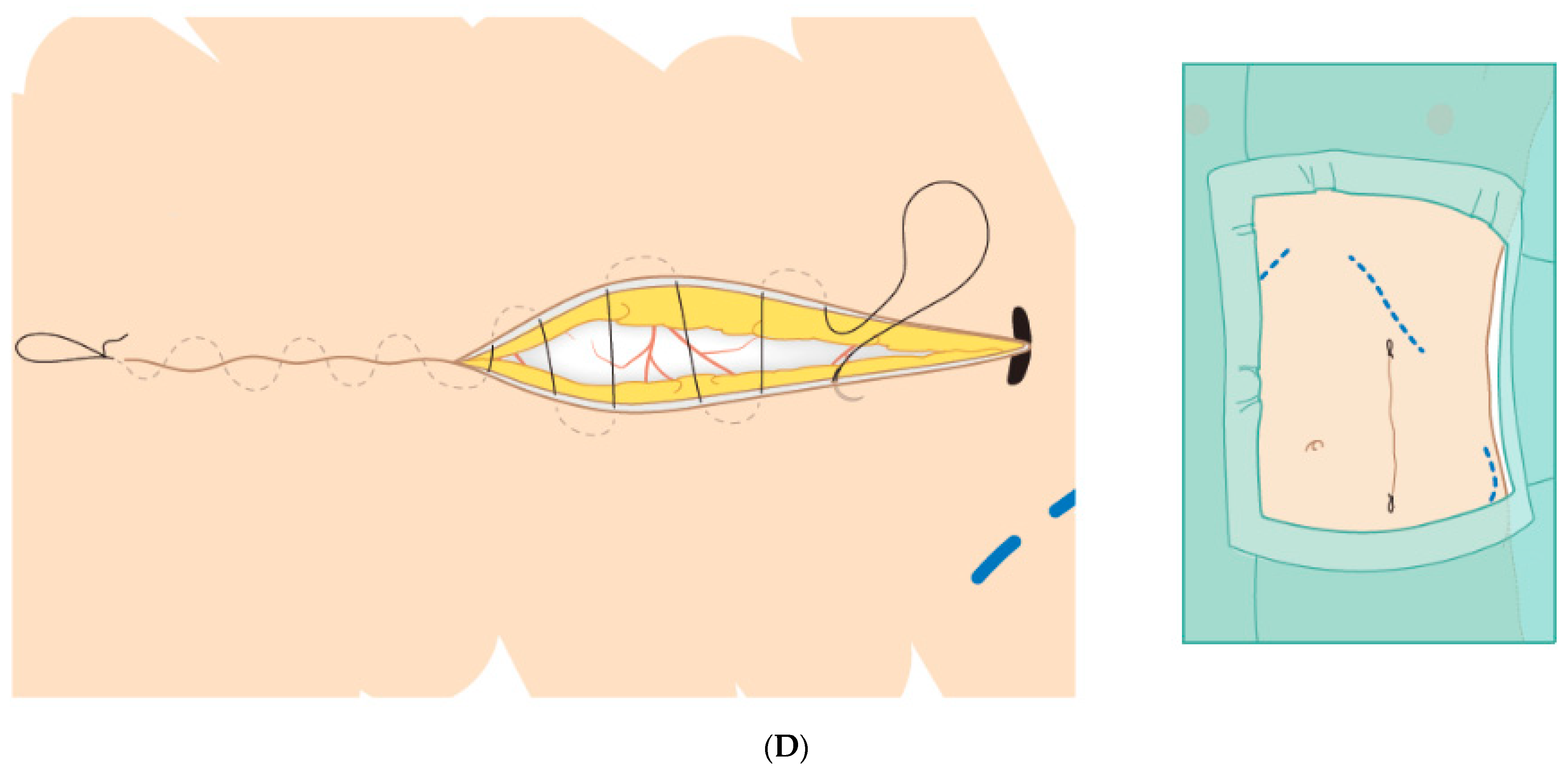 Transplantology 04 00001 g001c