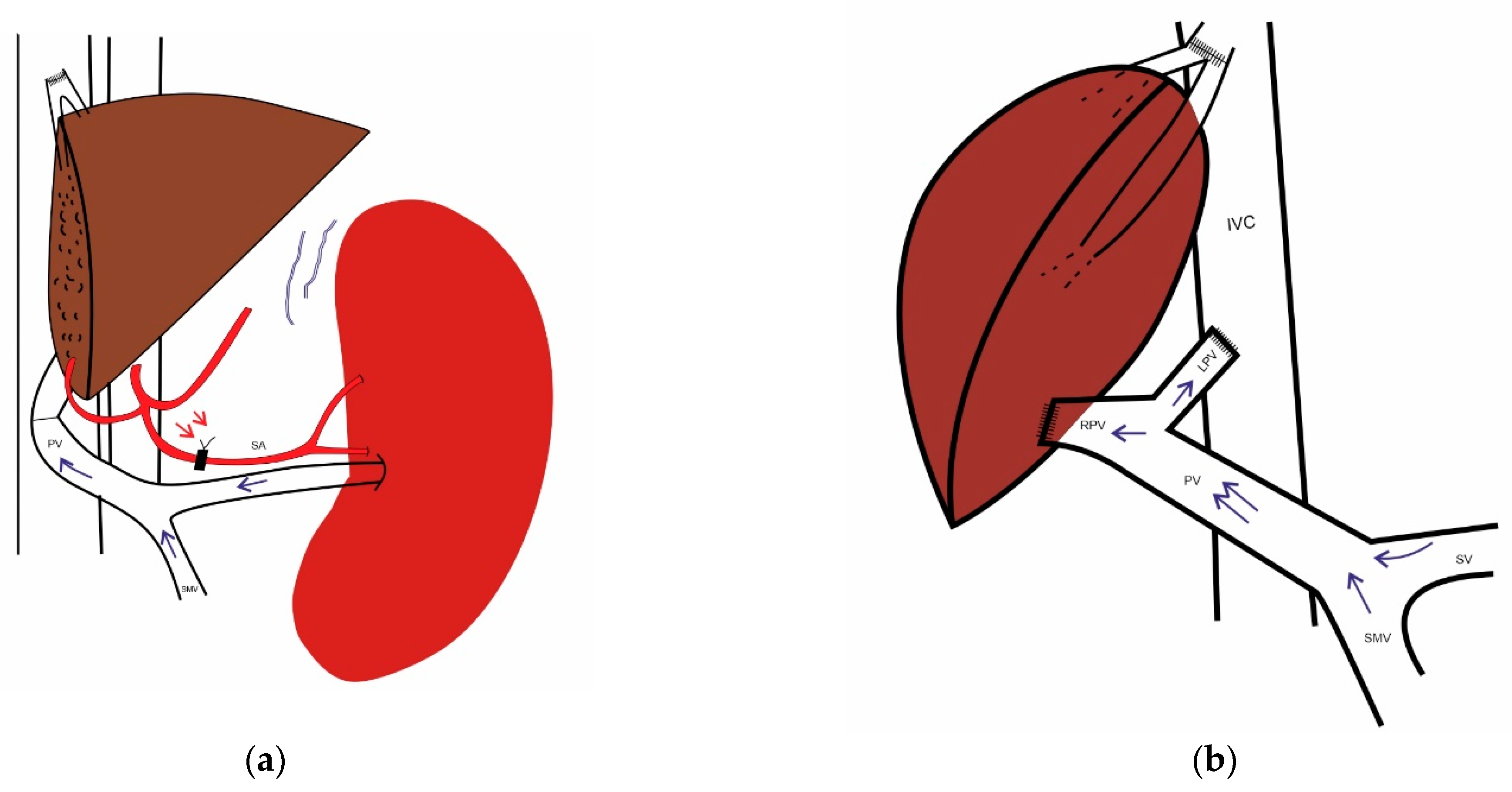 Transplantology 04 00006 g006 Transplantology 04 00006 g006