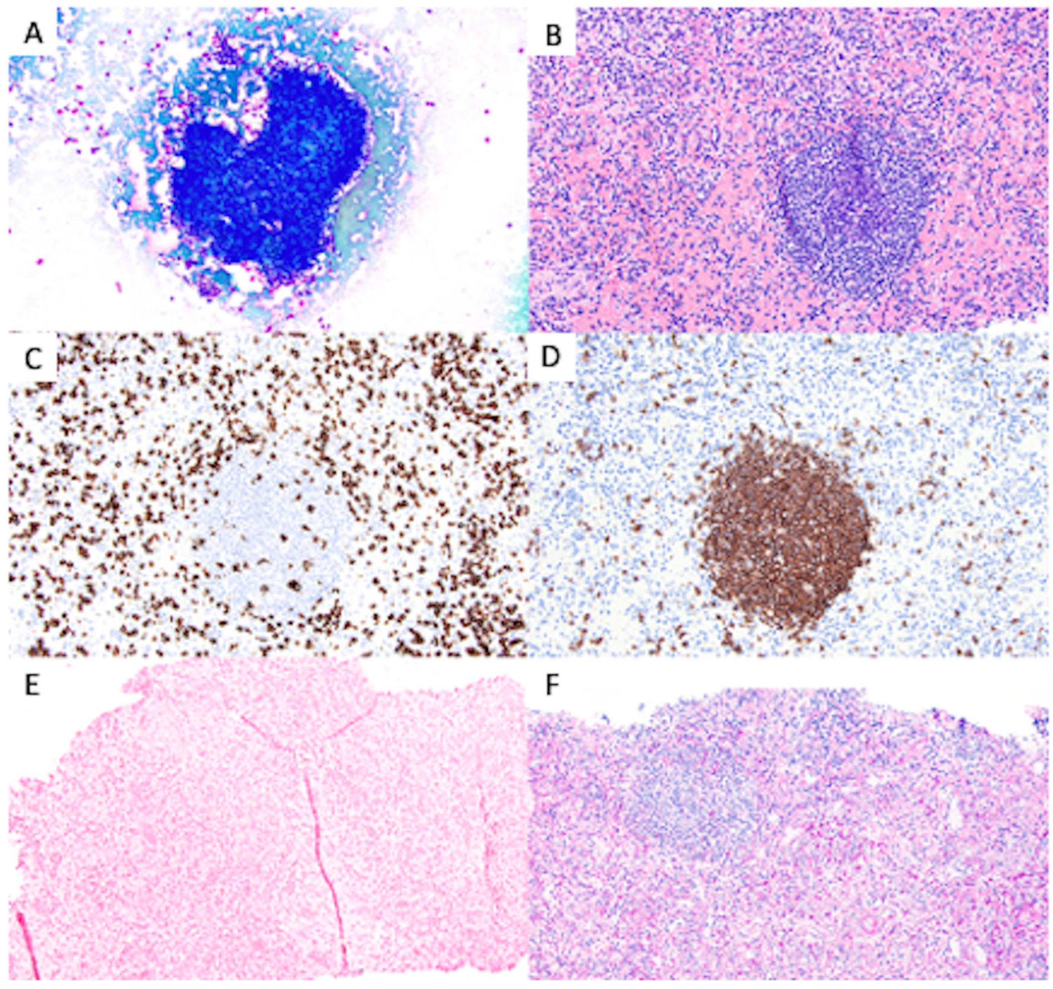Transplantology 04 00017 g002