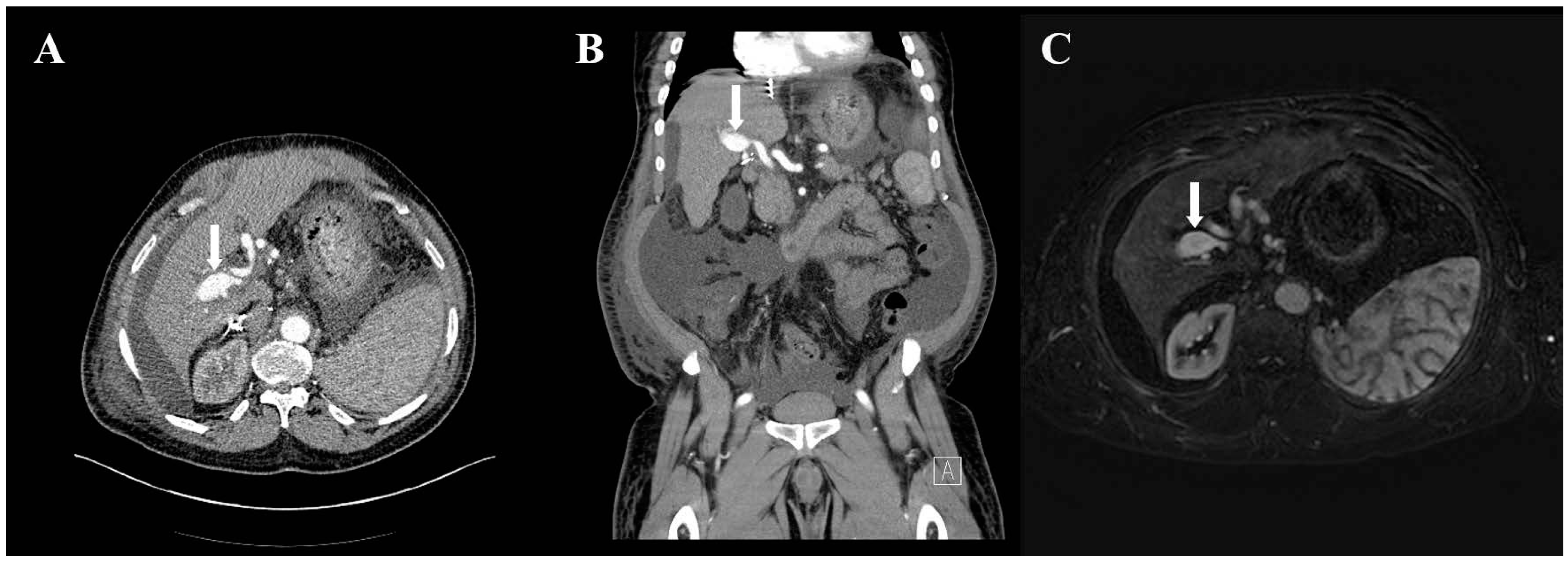 Transplantology 05 00011 g001