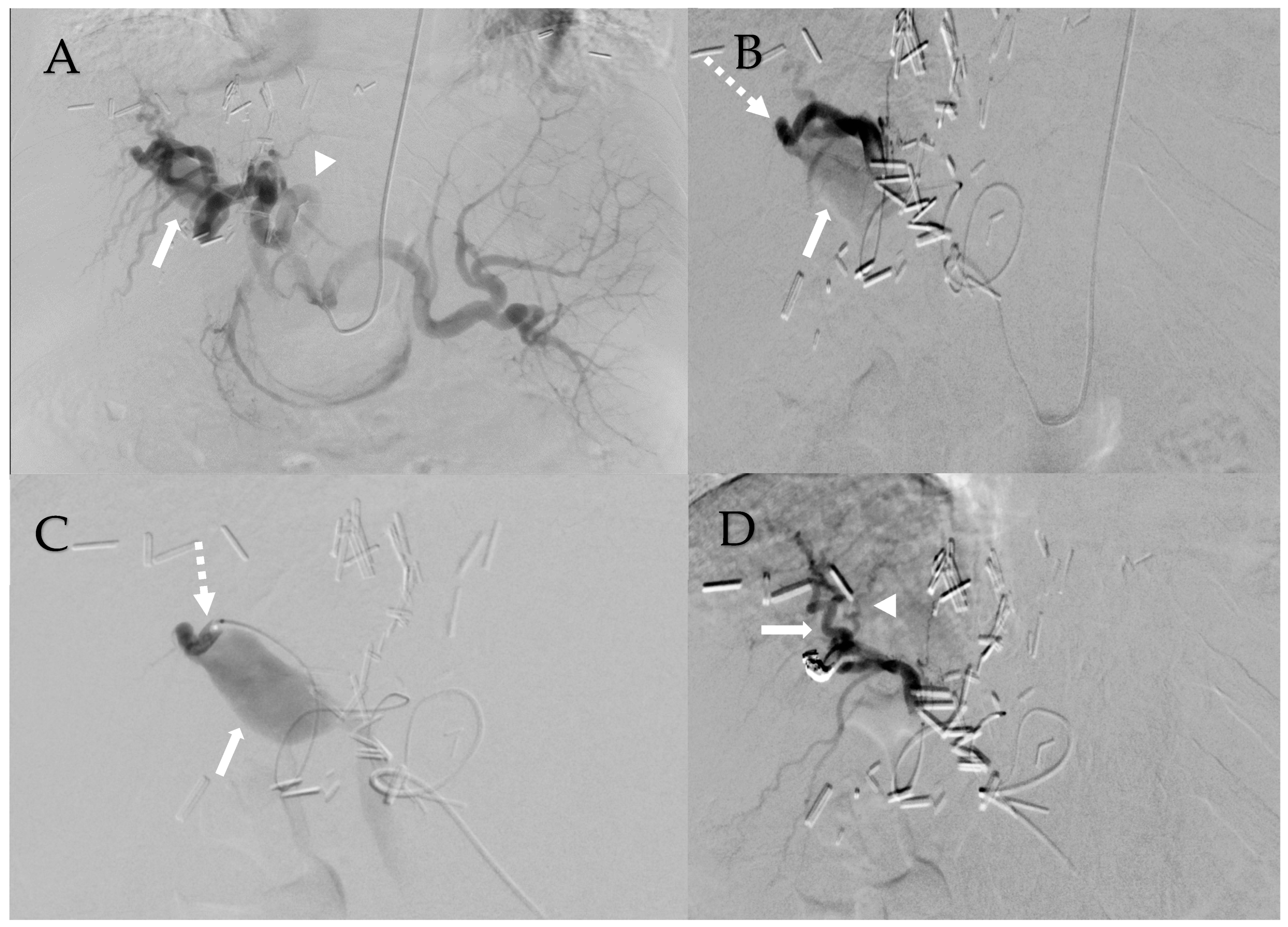 Transplantology 05 00011 g002
