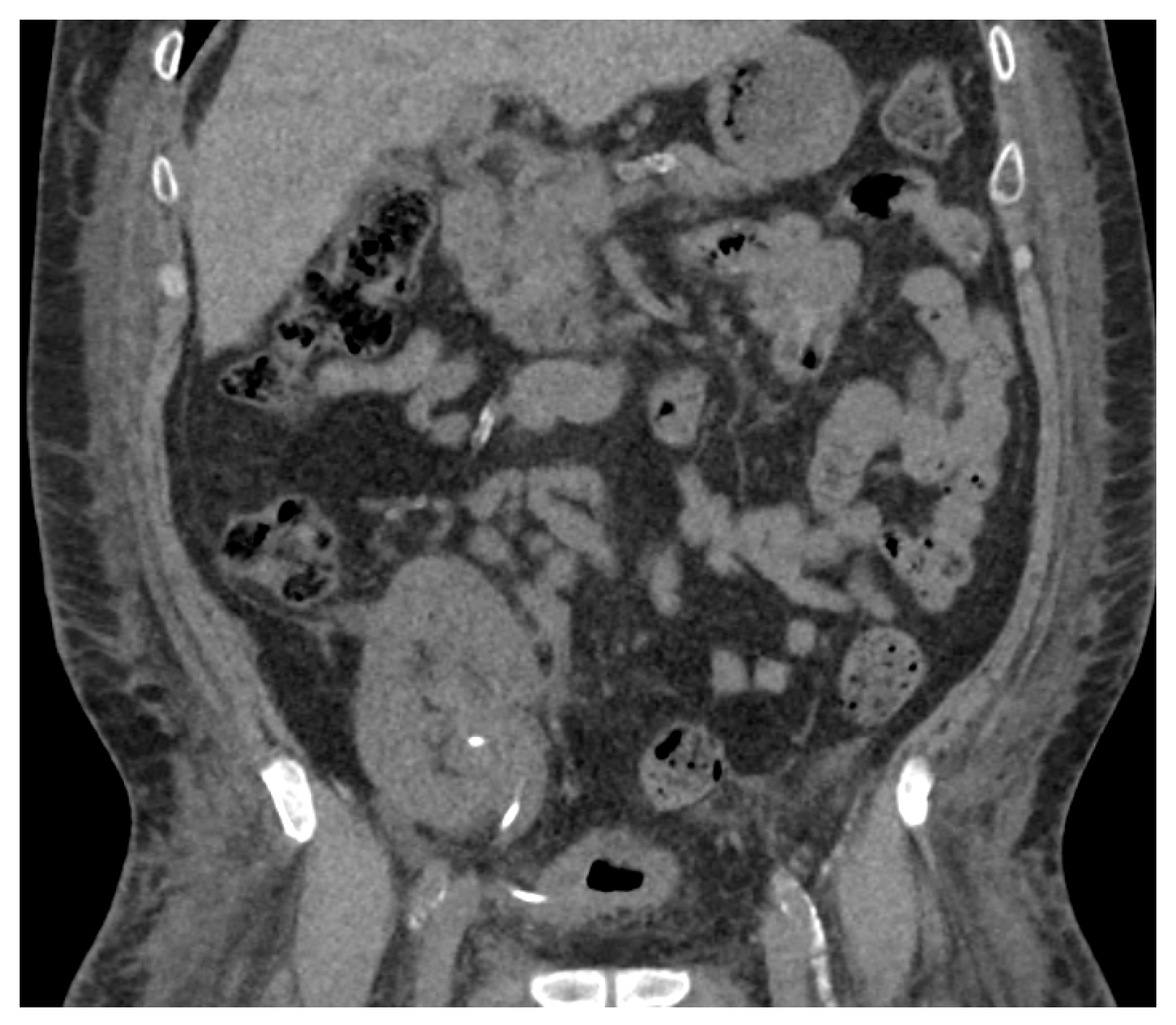 Transplantology 05 00026 g002
