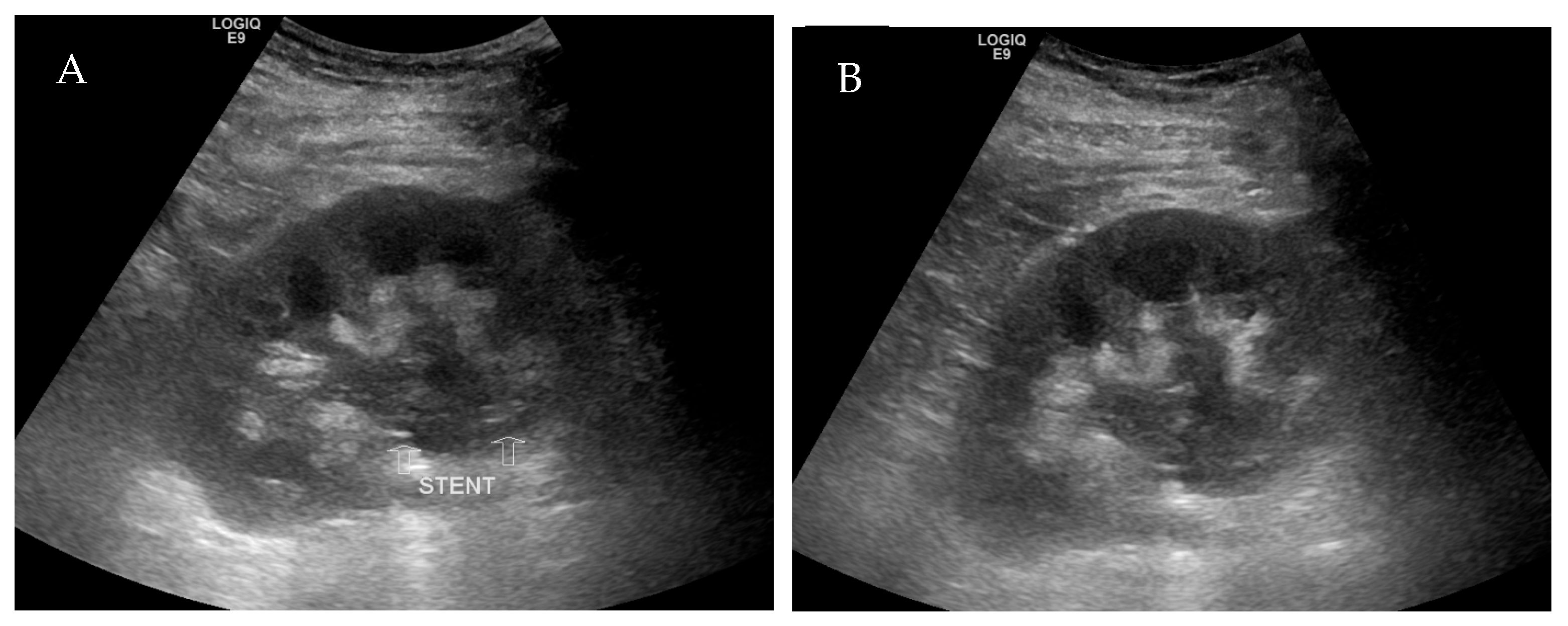 Transplantology 05 00026 g003