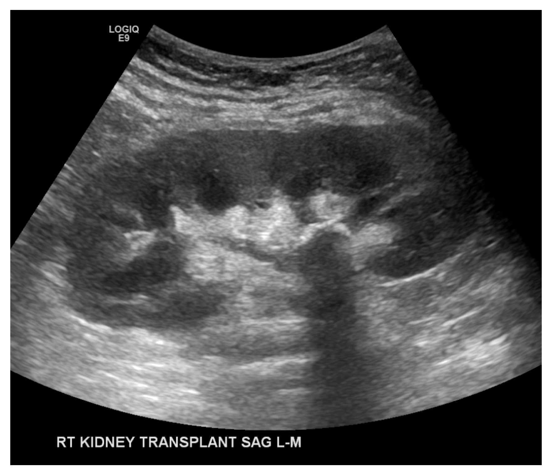 Transplantology 05 00026 g004