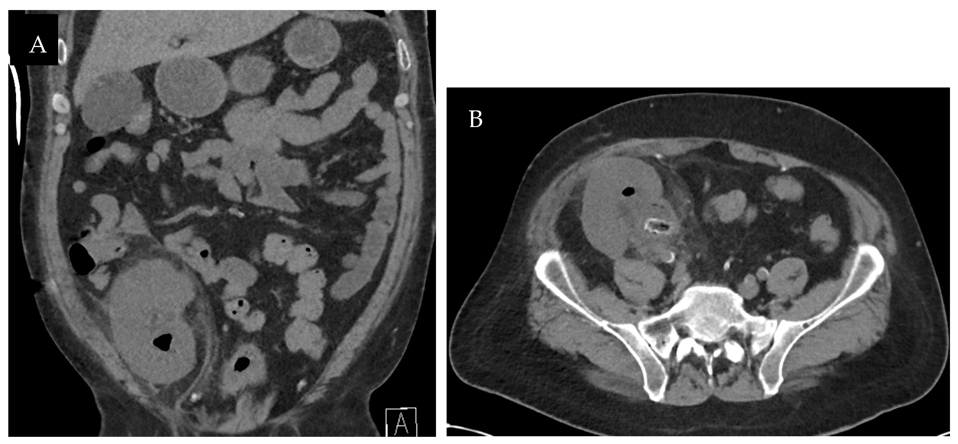 Transplantology 05 00026 g006