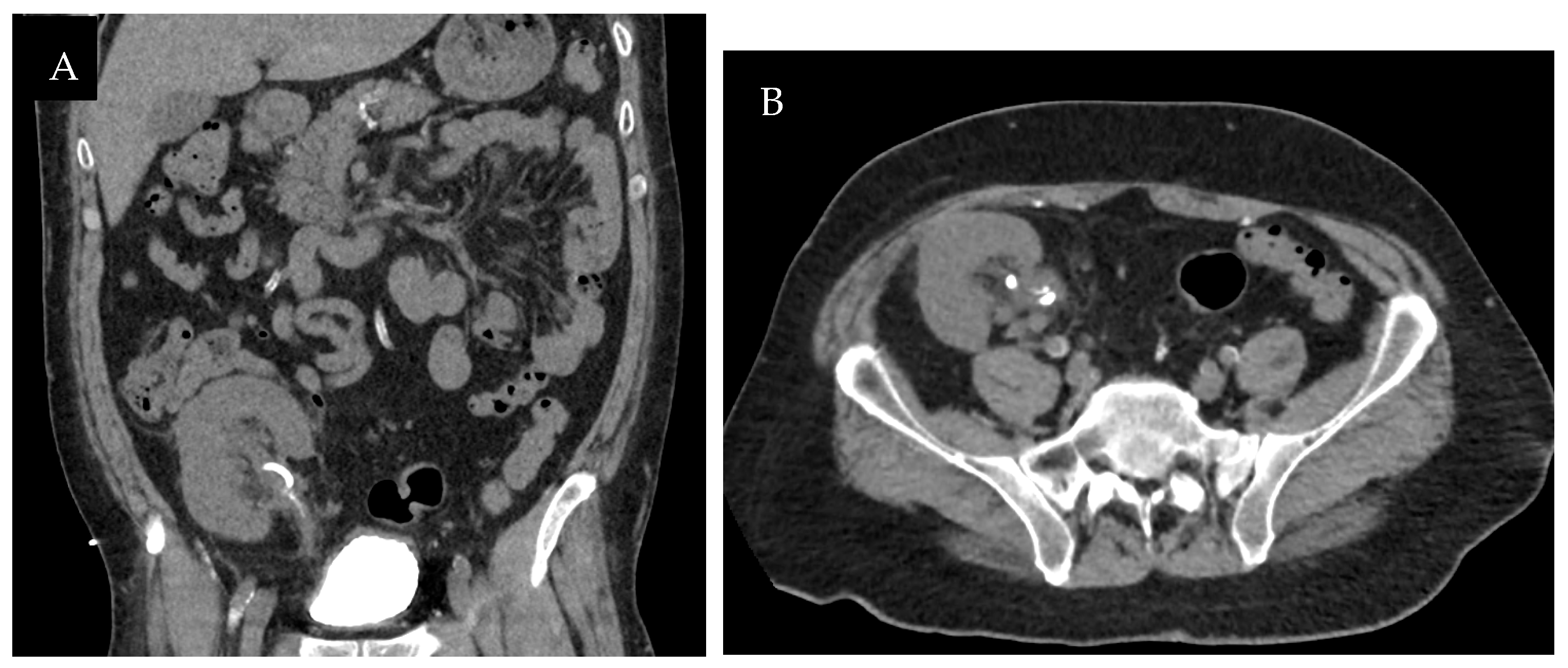 Transplantology 05 00026 g008