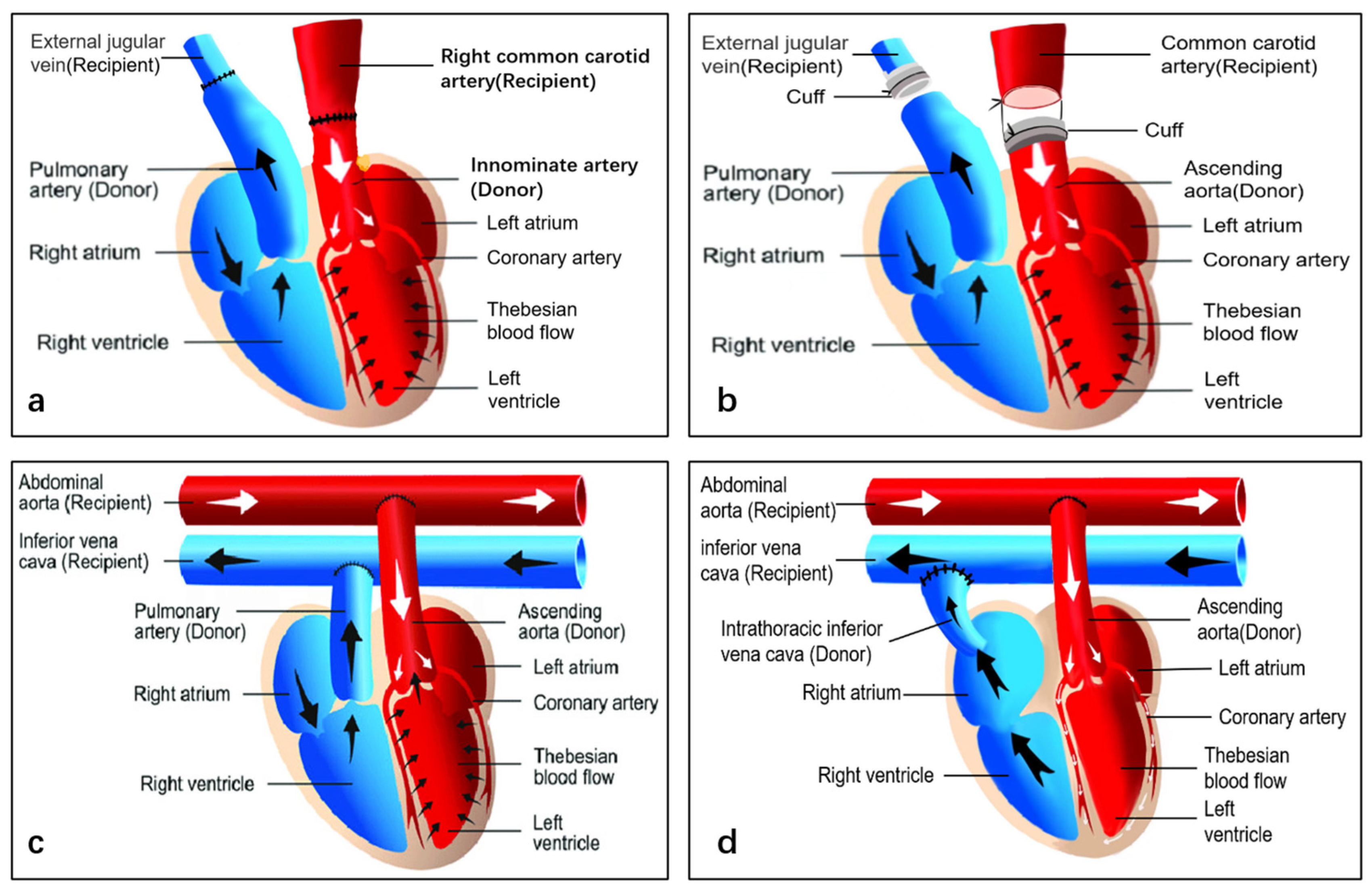 Transplantology 05 00030 g002
