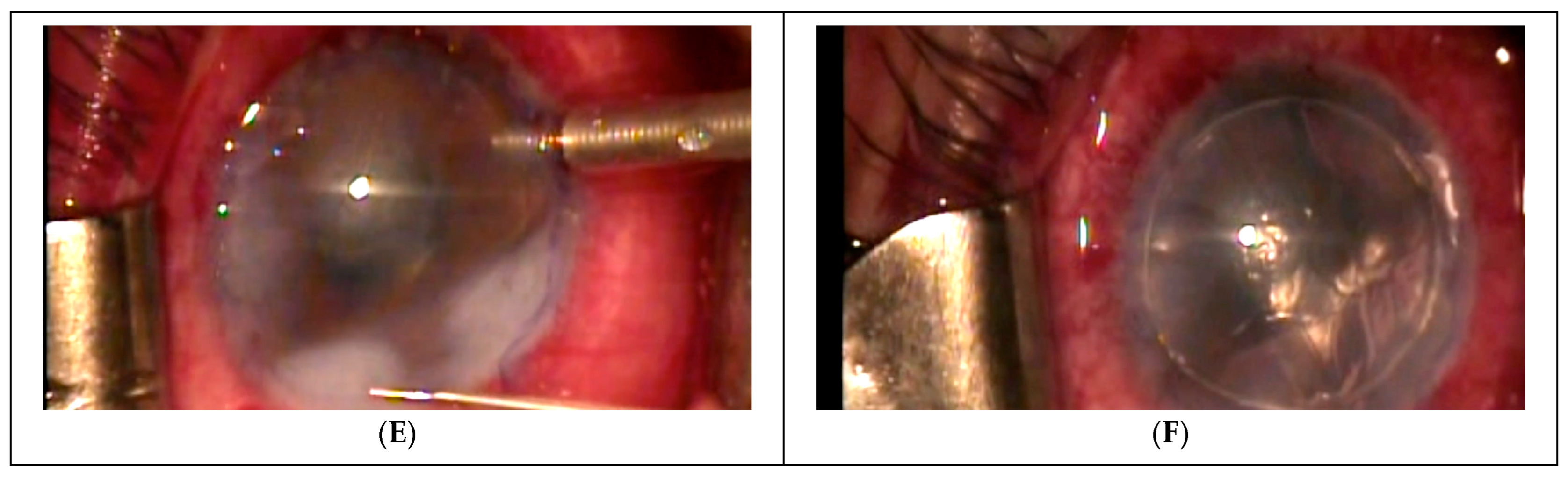 Transplantology 06 00004 g001b