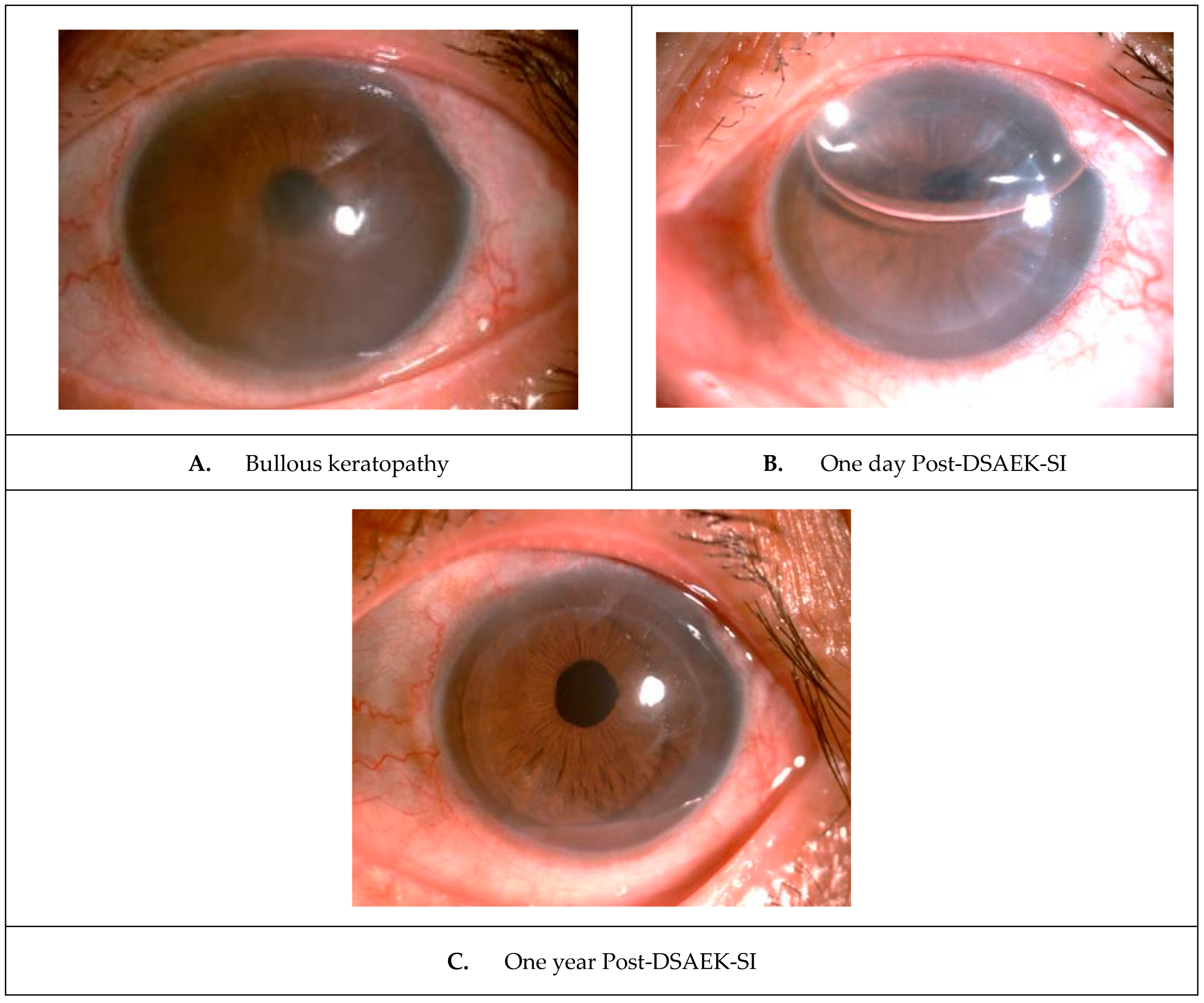 Transplantology 06 00004 g002