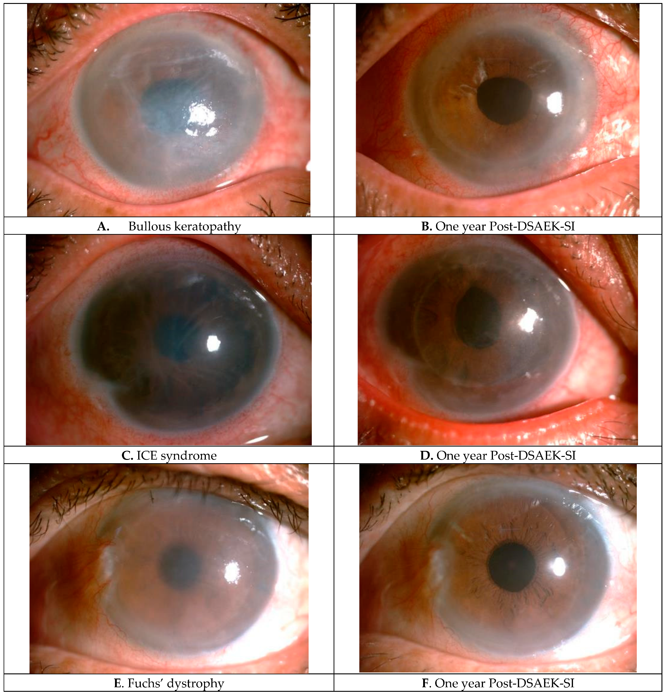 Transplantology 06 00004 g003