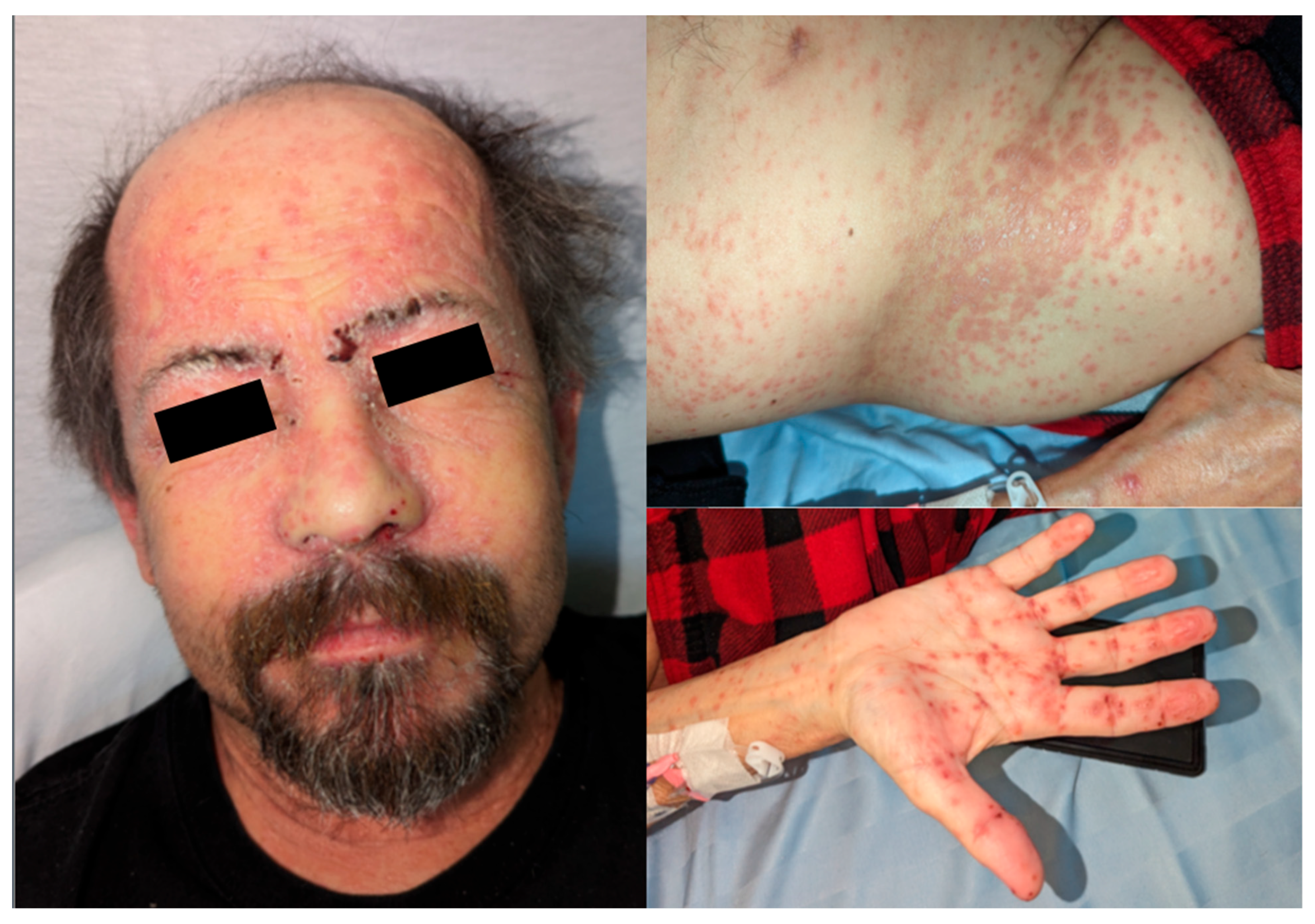 Transplantology 06 00024 g001