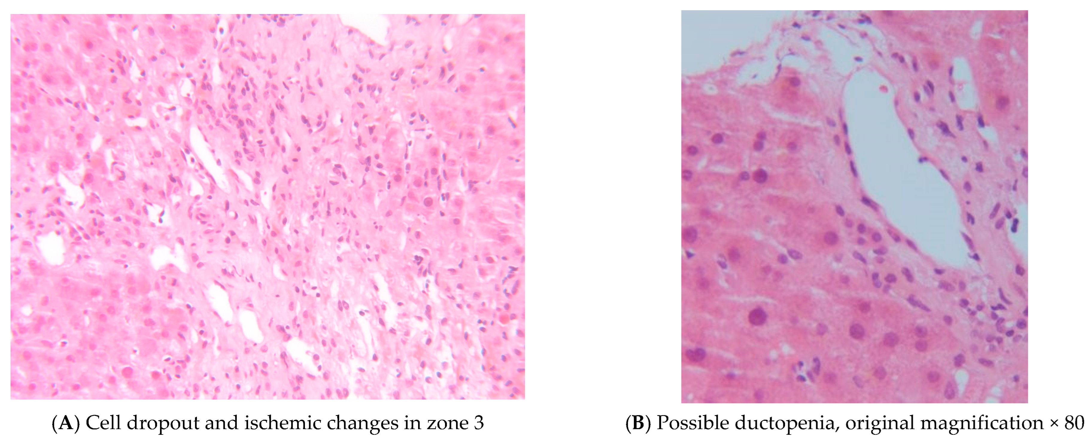 Transplantology 06 00024 g003