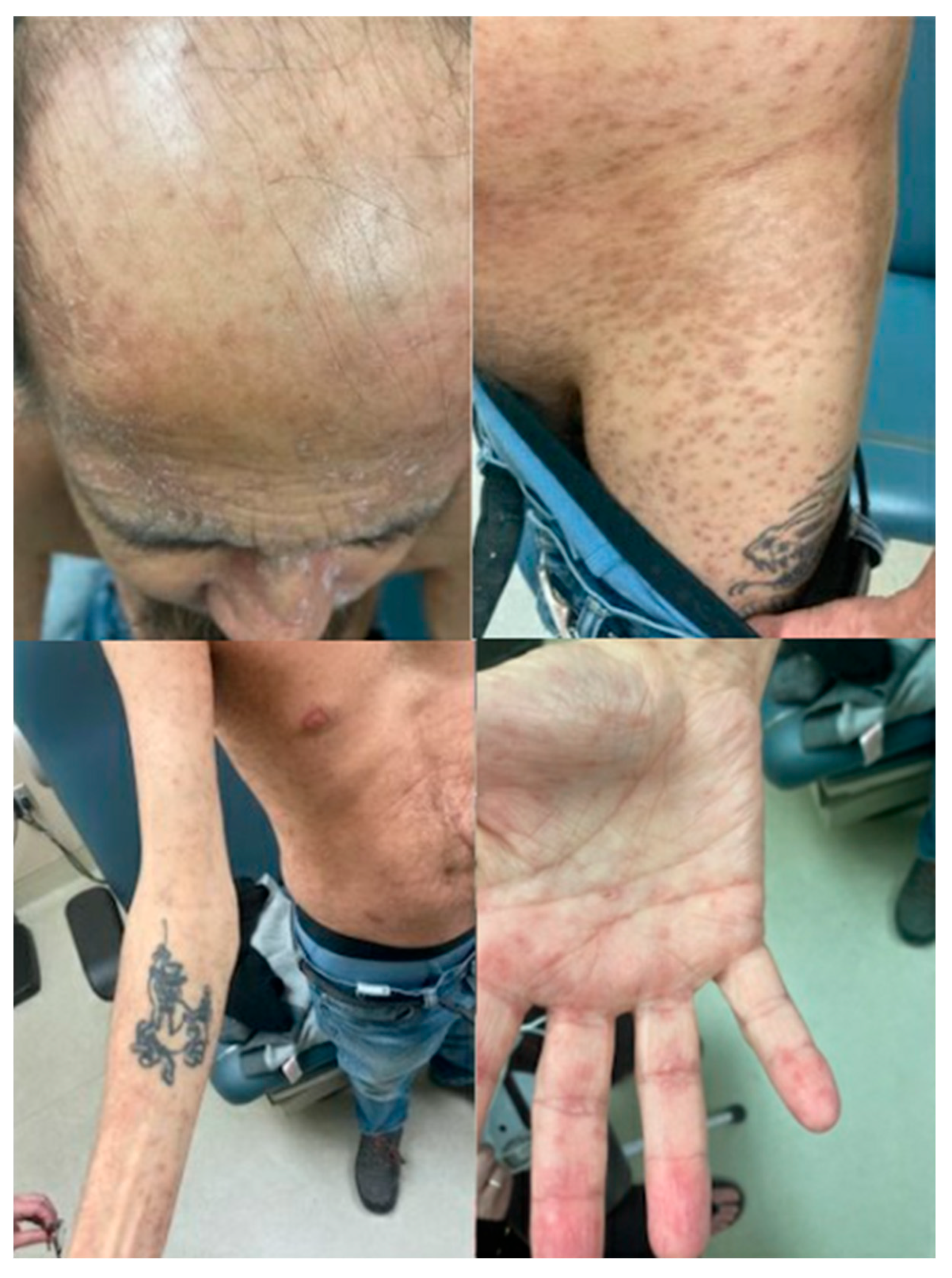 Transplantology 06 00024 g004