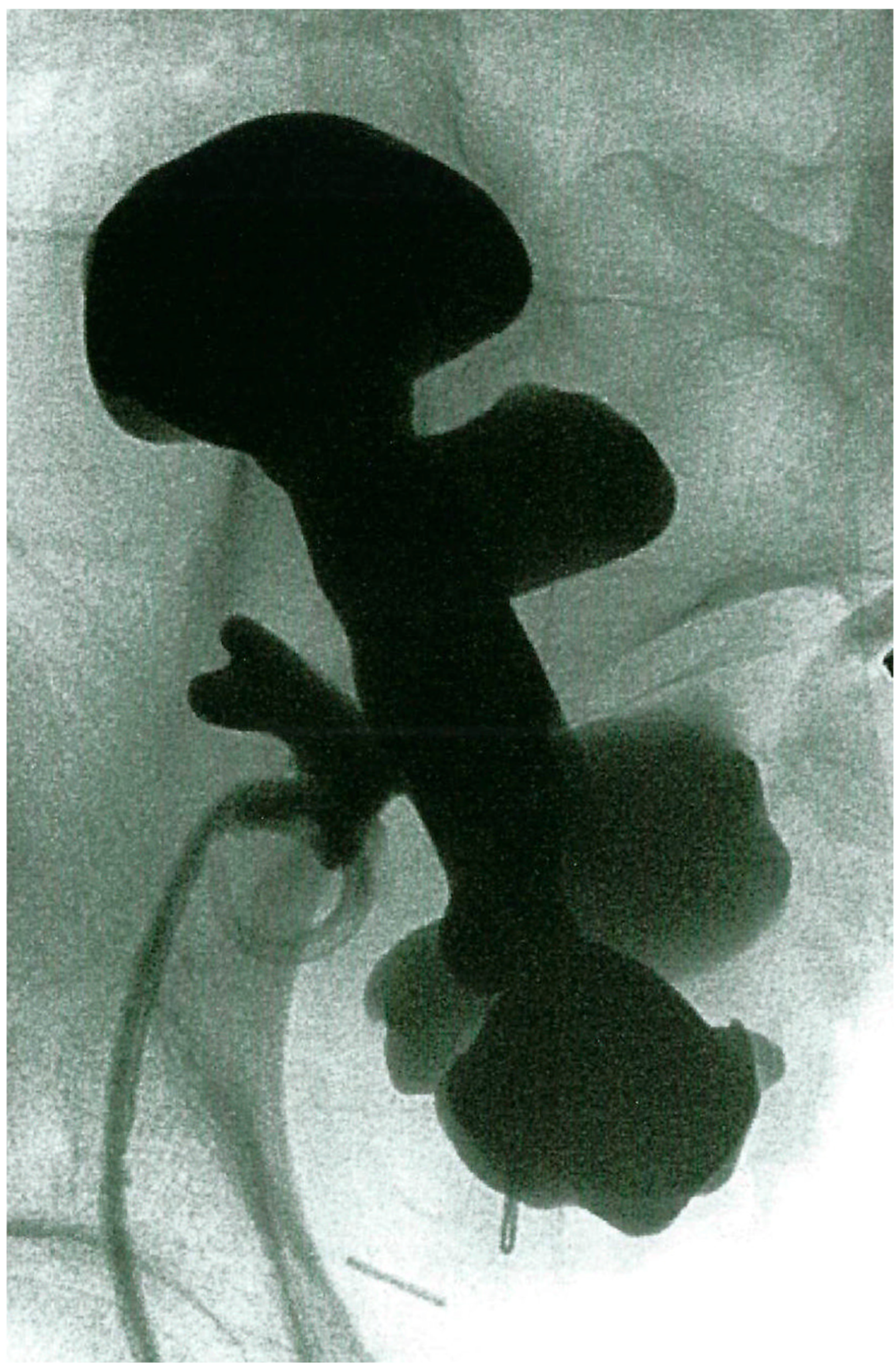 Transplantology 06 00027 g001 Transplantology 06 00027 g001