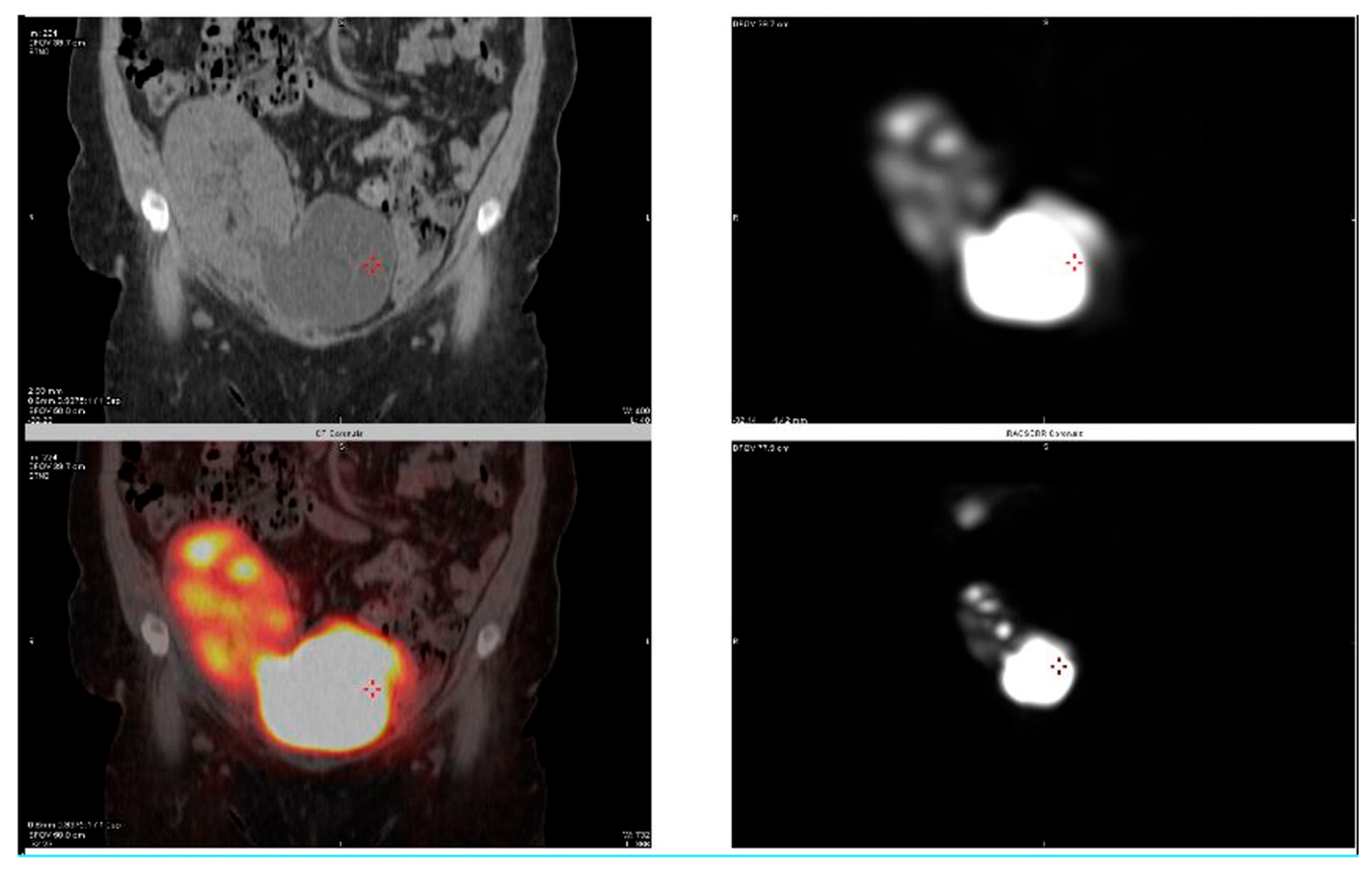 Transplantology 06 00027 g004 Transplantology 06 00027 g004