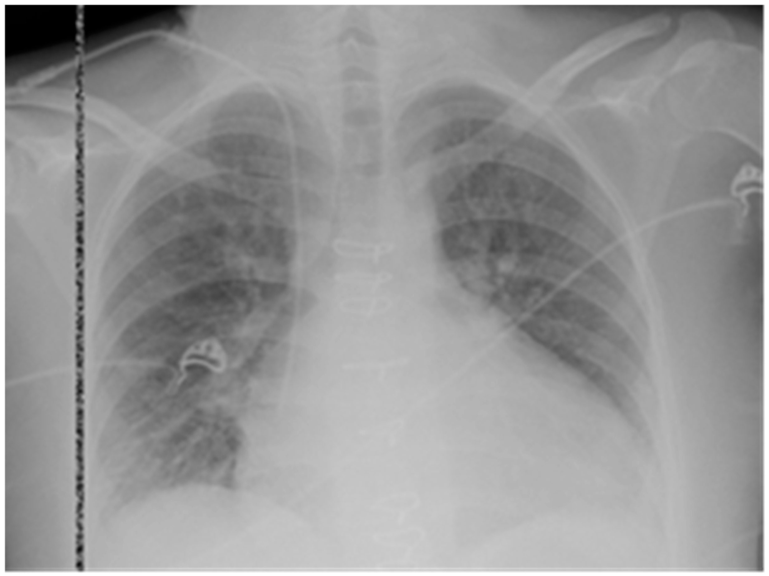 Transplantology 06 00029 g001 Transplantology 06 00029 g001