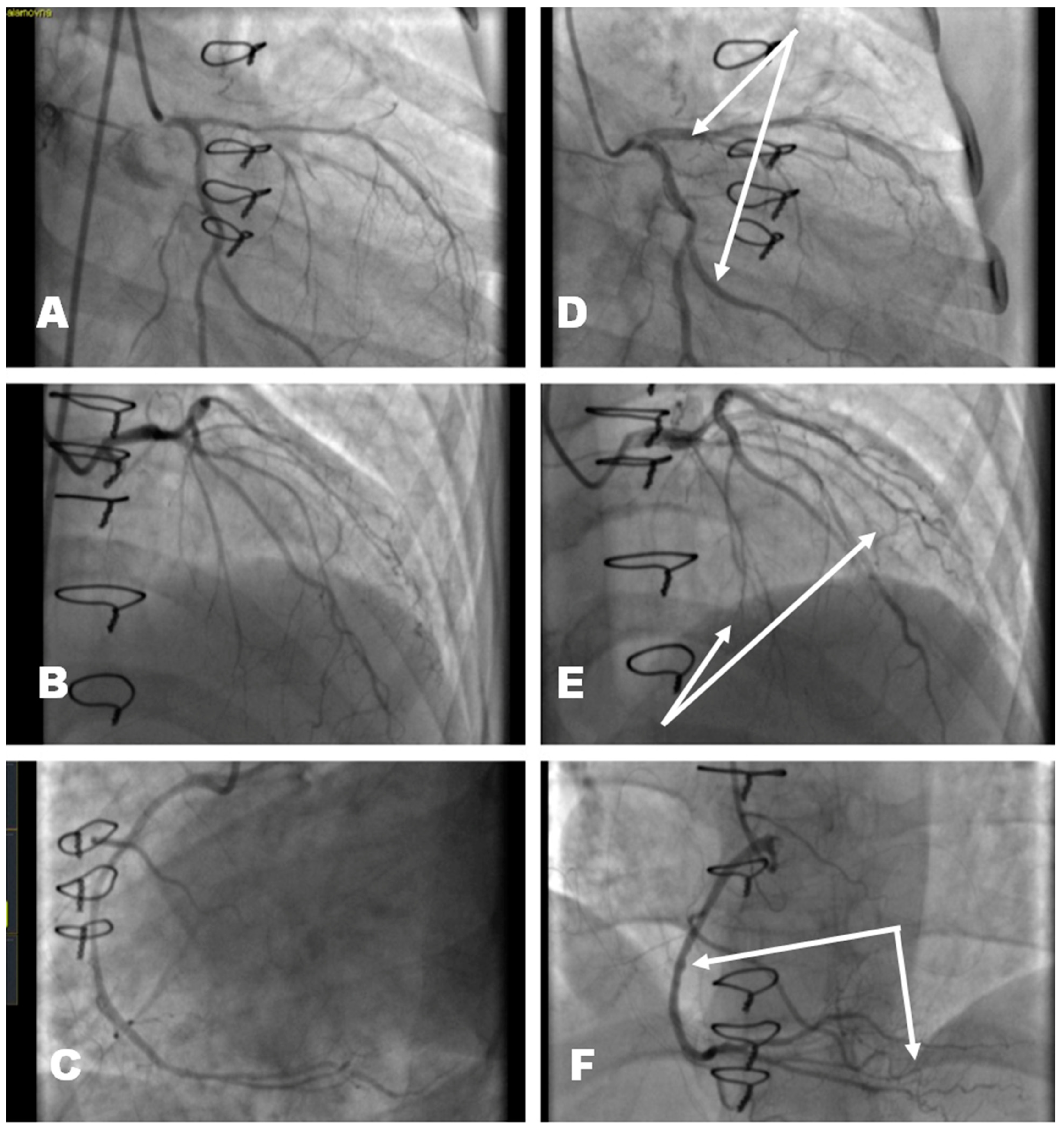 Transplantology 06 00029 g002 Transplantology 06 00029 g002