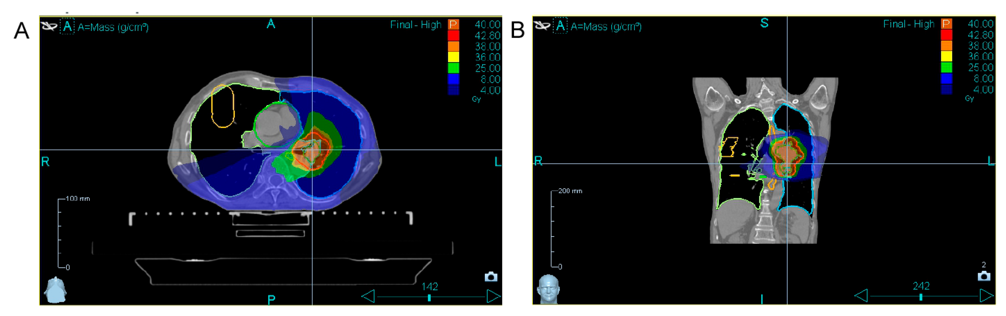 Transplantology 06 00037 g002 Transplantology 06 00037 g002