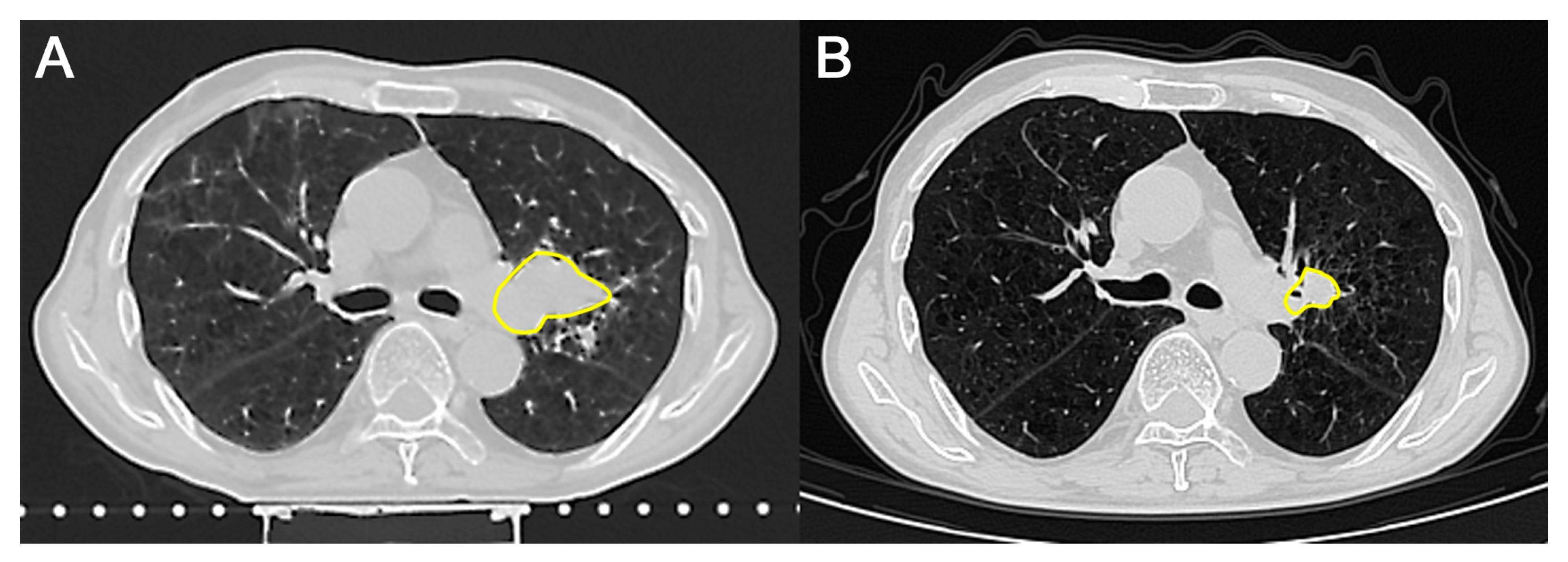 Transplantology 06 00037 g003 Transplantology 06 00037 g003