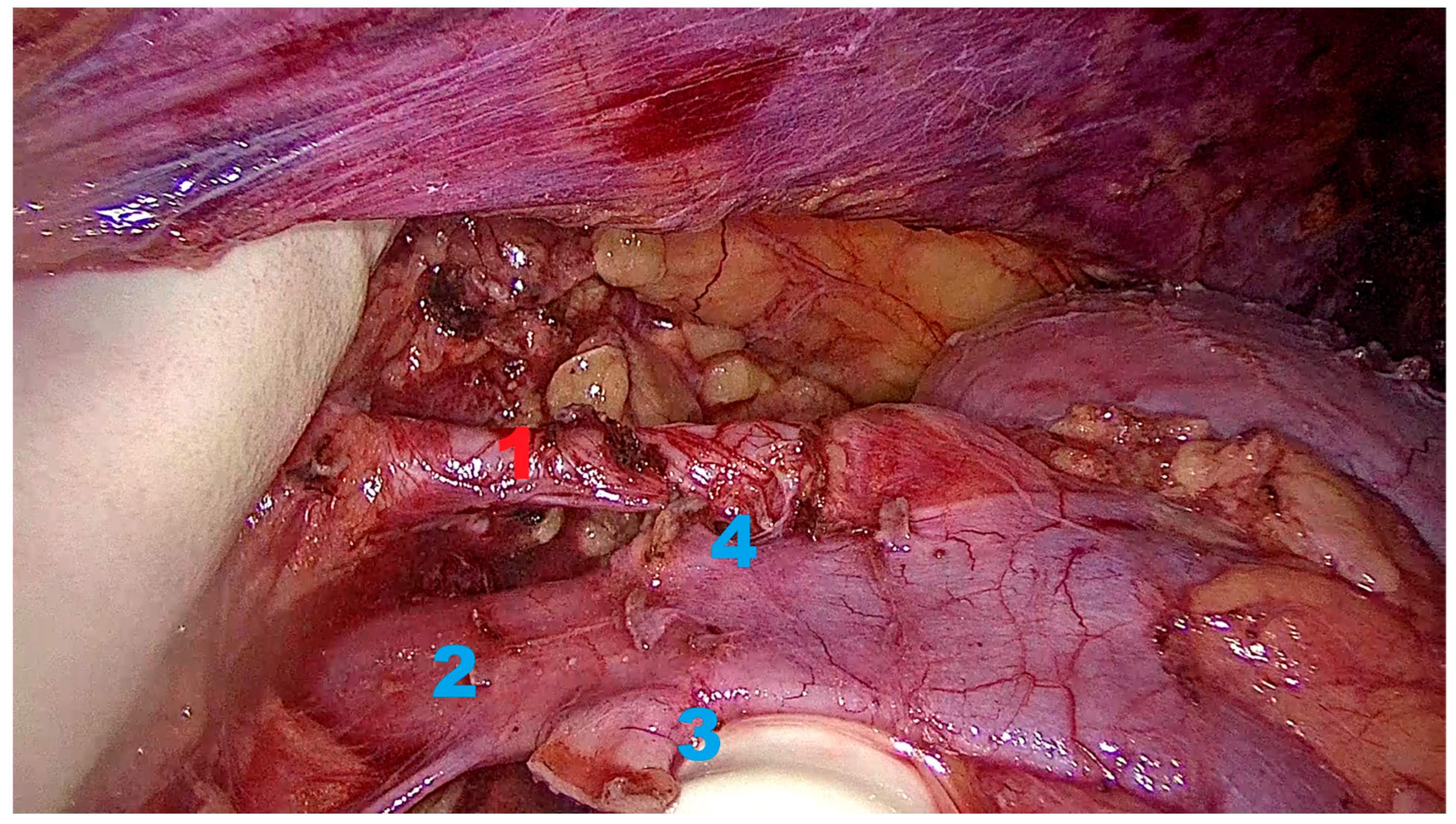 Transplantology 06 00038 g001 Transplantology 06 00038 g001