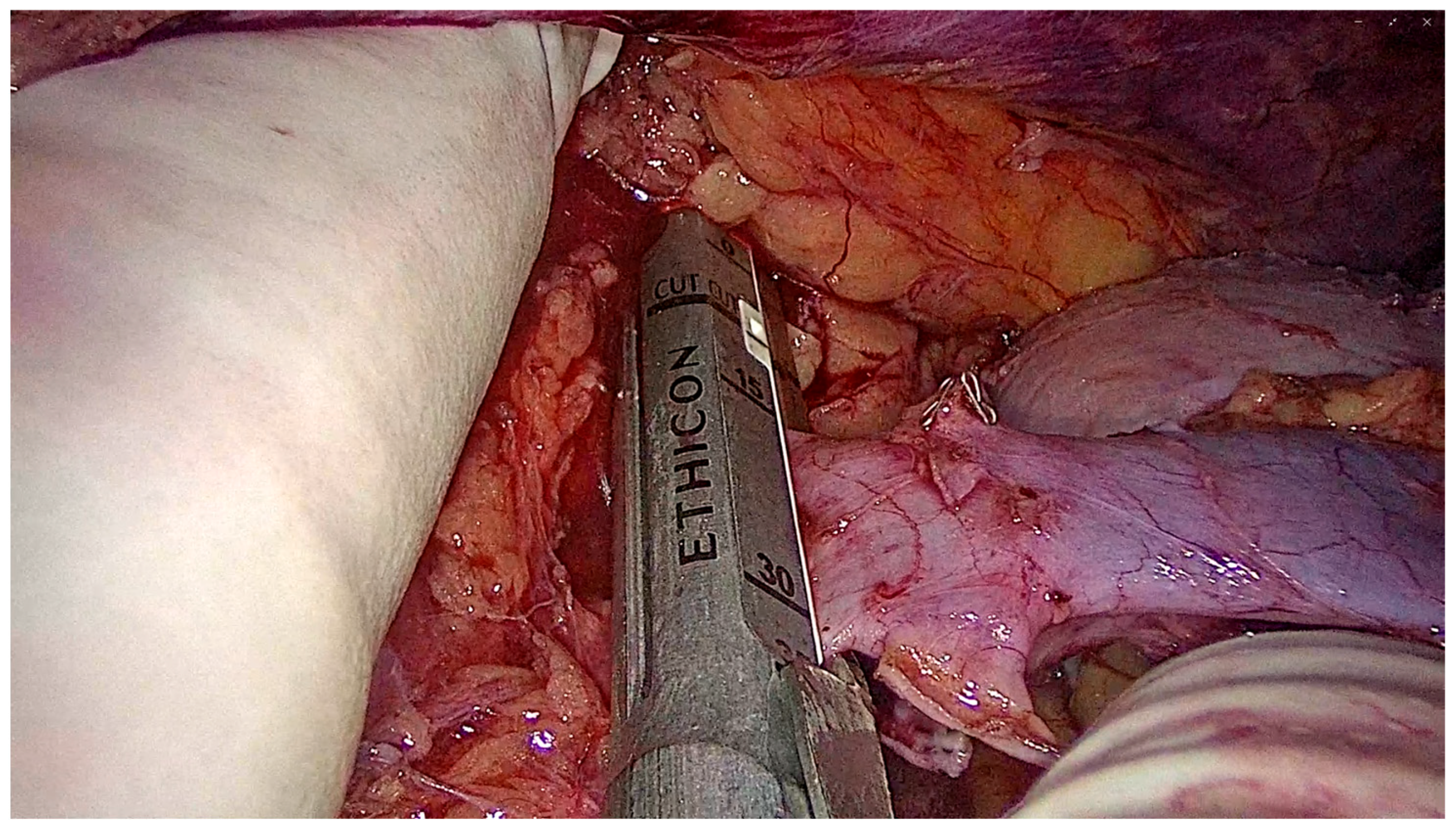 Transplantology 06 00038 g002 Transplantology 06 00038 g002