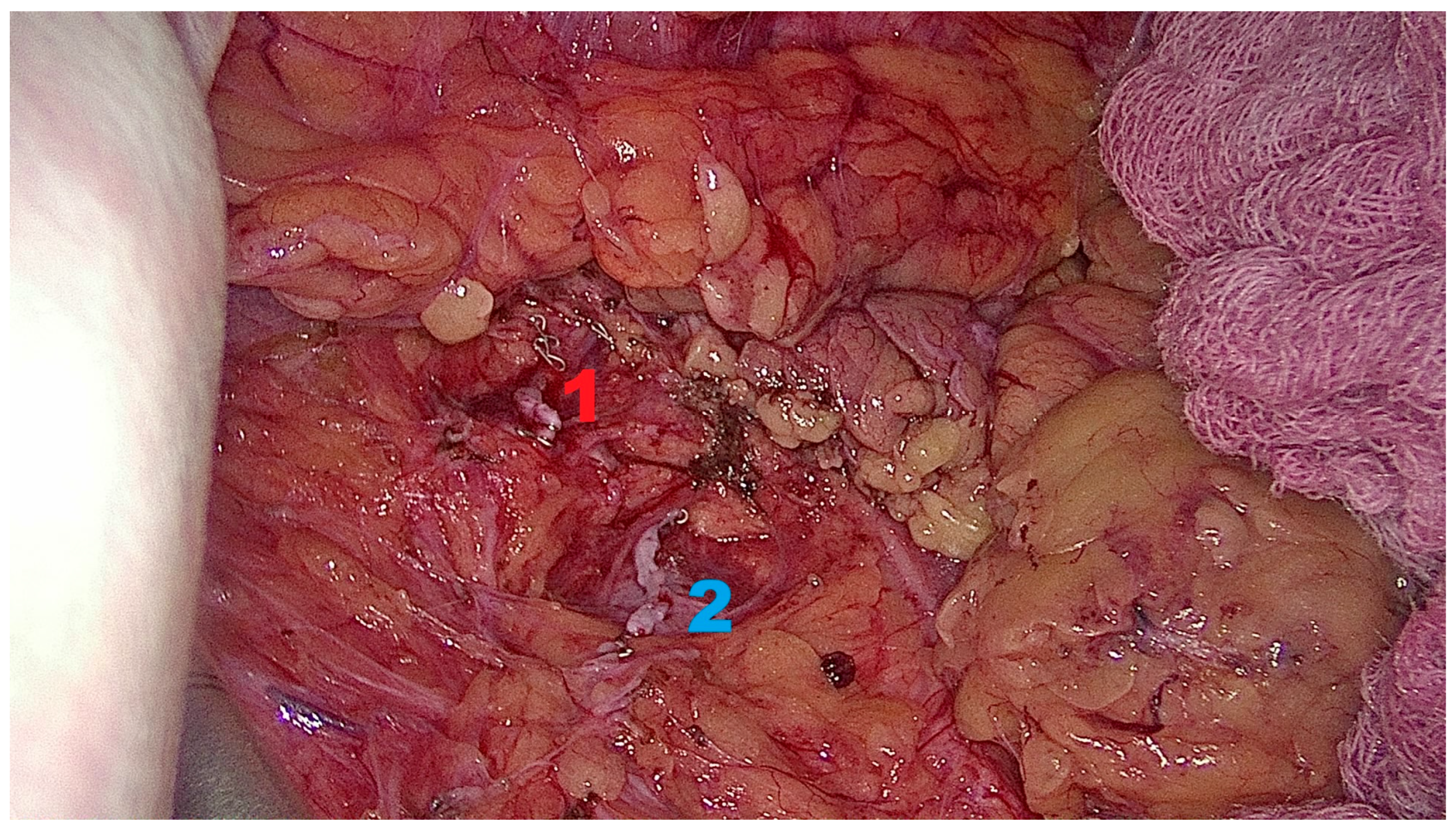 Transplantology 06 00038 g003 Transplantology 06 00038 g003