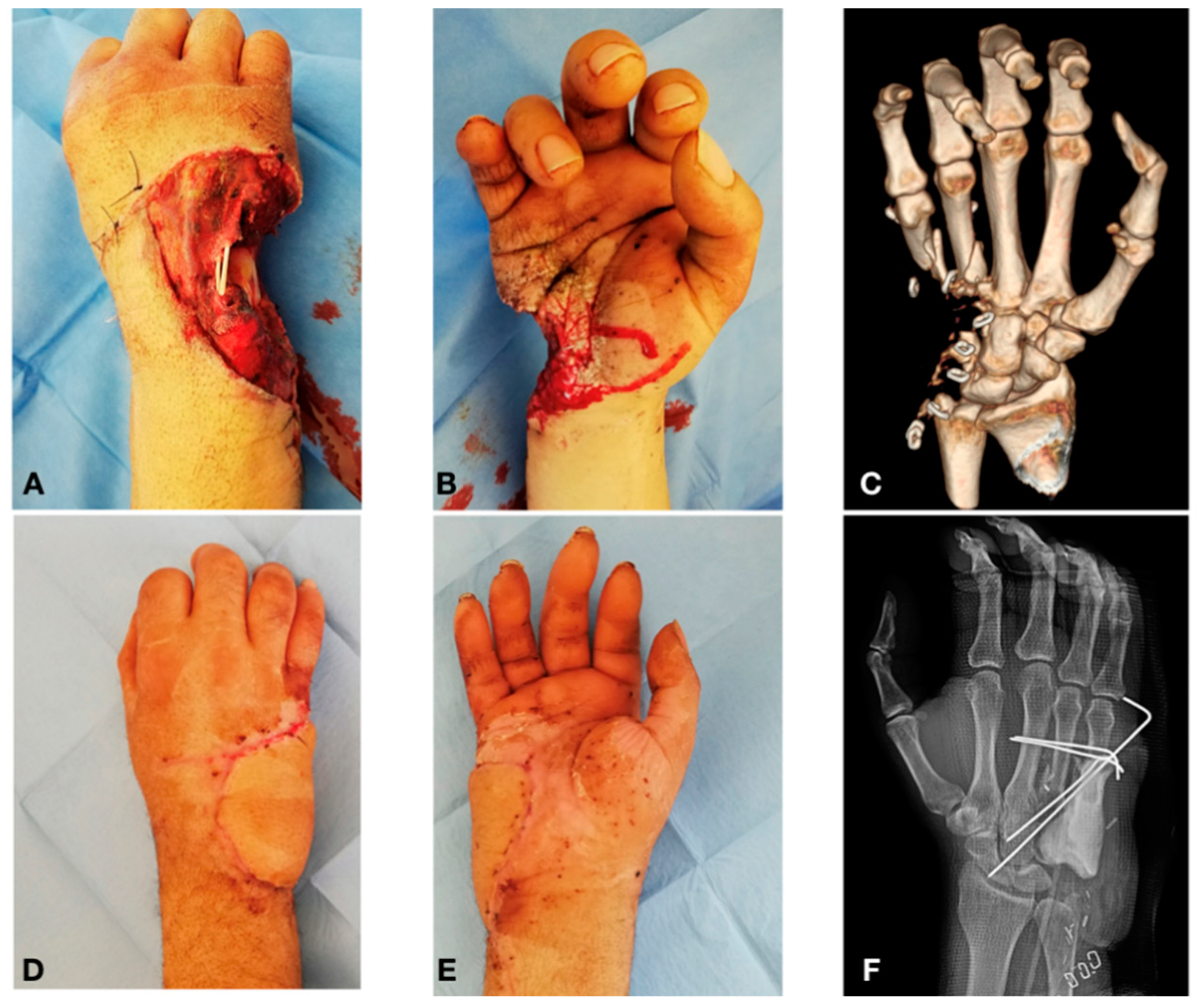 Traumacare 01 00002 g002 Traumacare 01 00002 g002
