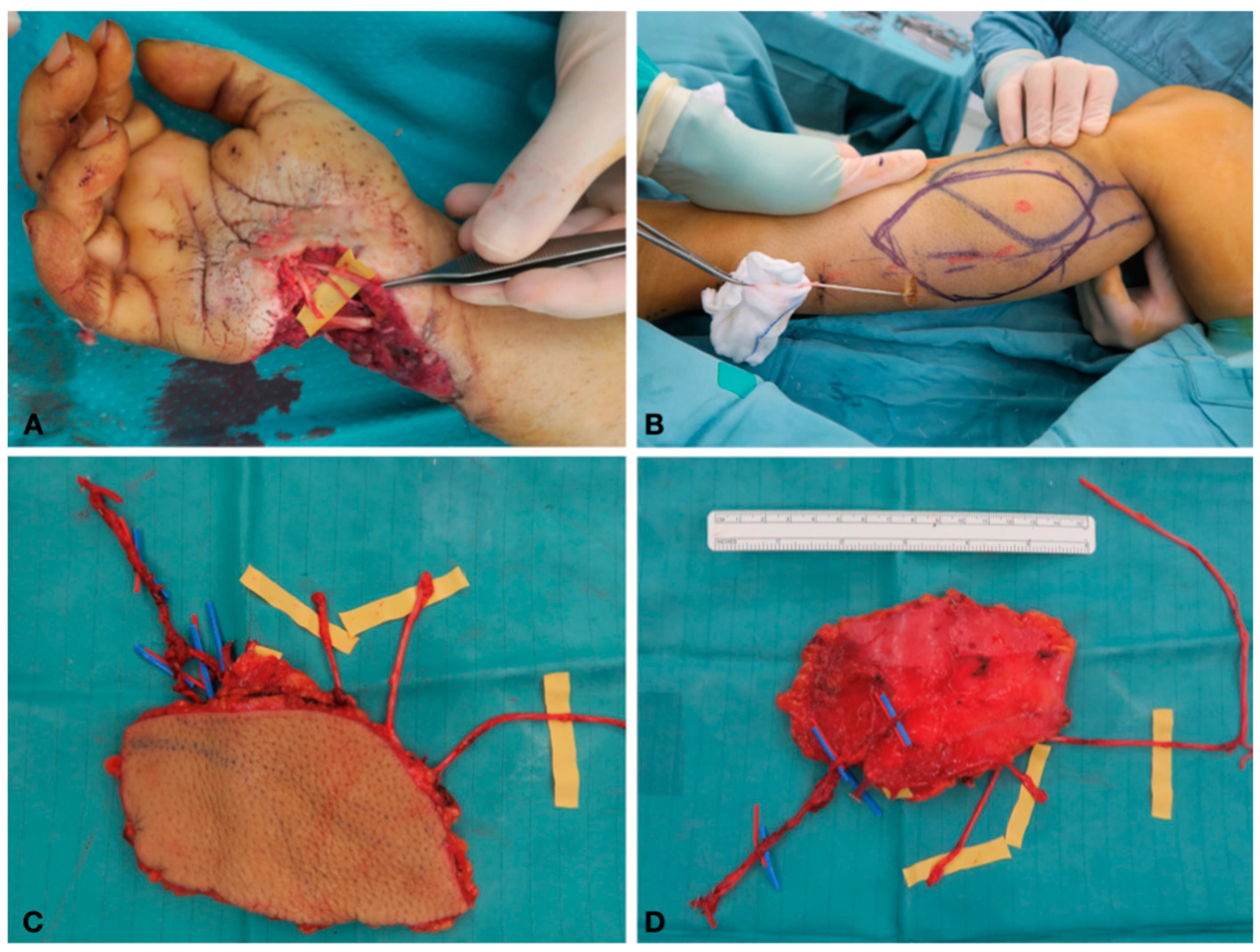 Traumacare 01 00002 g003 Traumacare 01 00002 g003