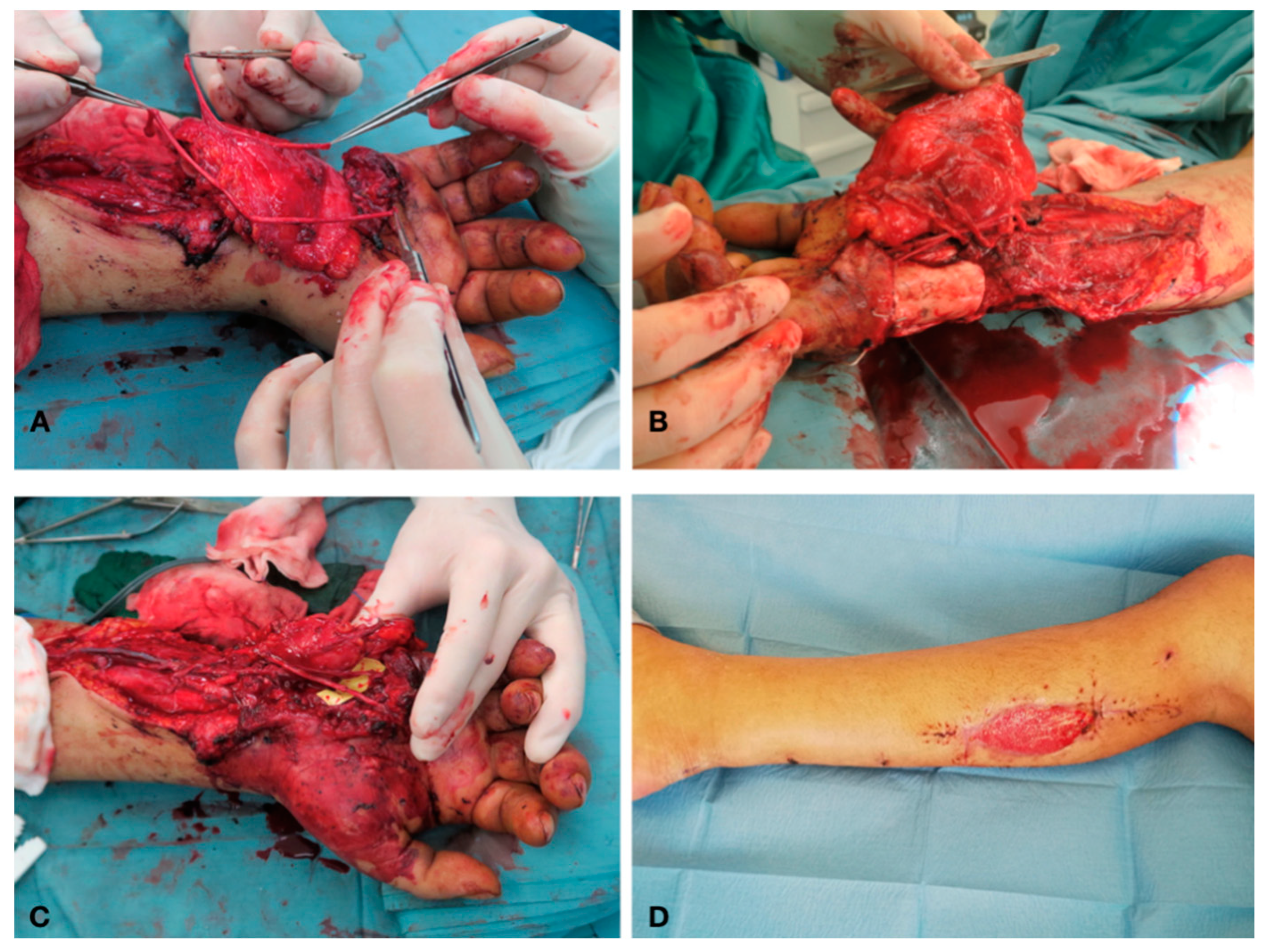 Traumacare 01 00002 g004 Traumacare 01 00002 g004