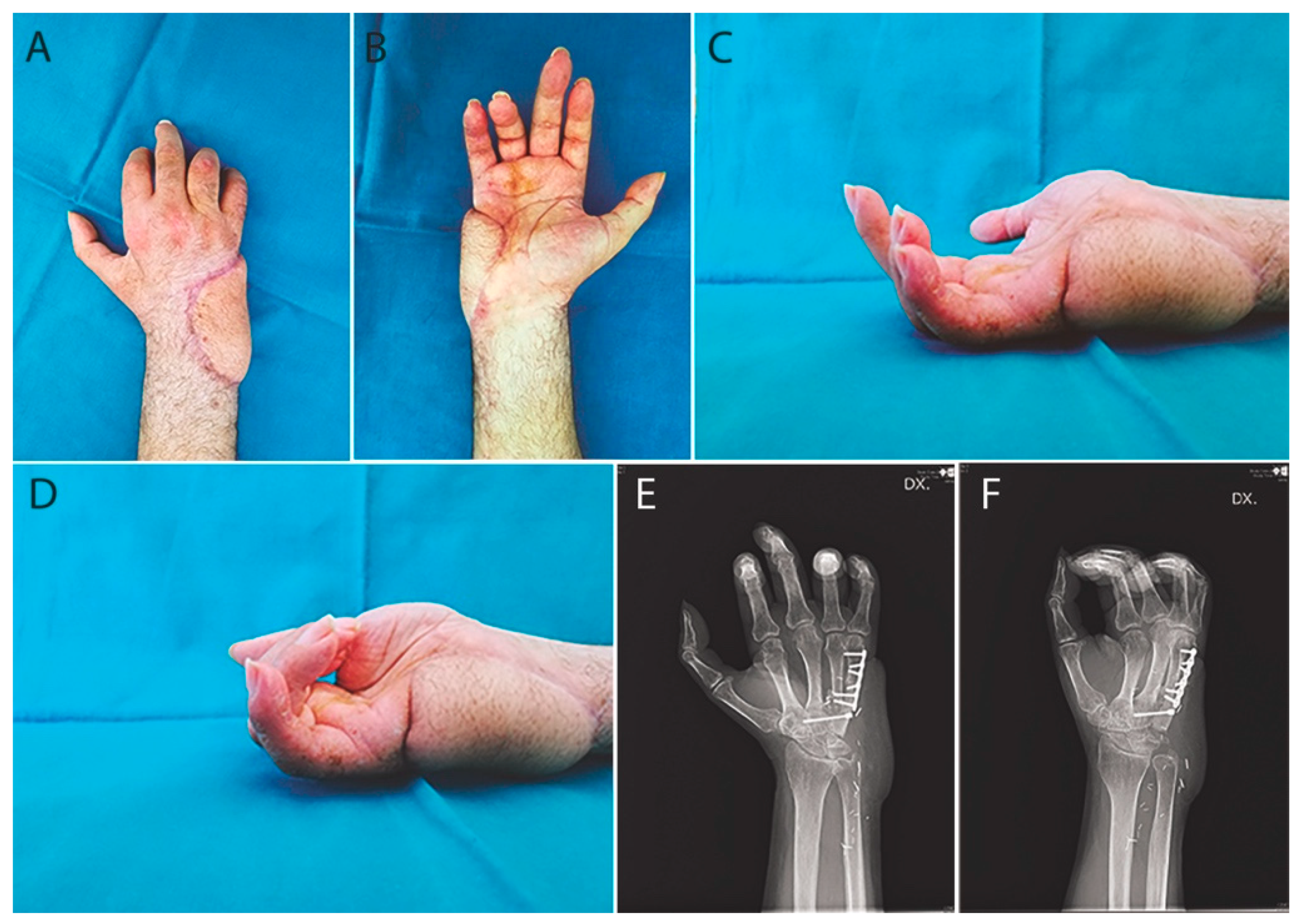 Traumacare 01 00002 g005 Traumacare 01 00002 g005