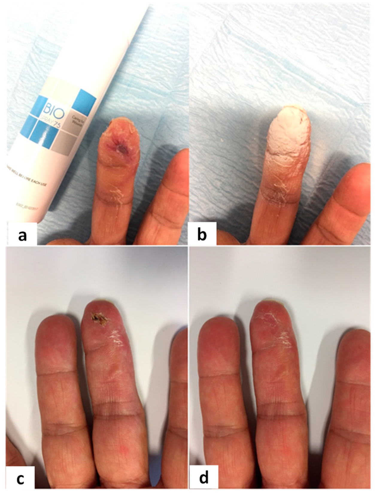 Traumacare 01 00017 g004