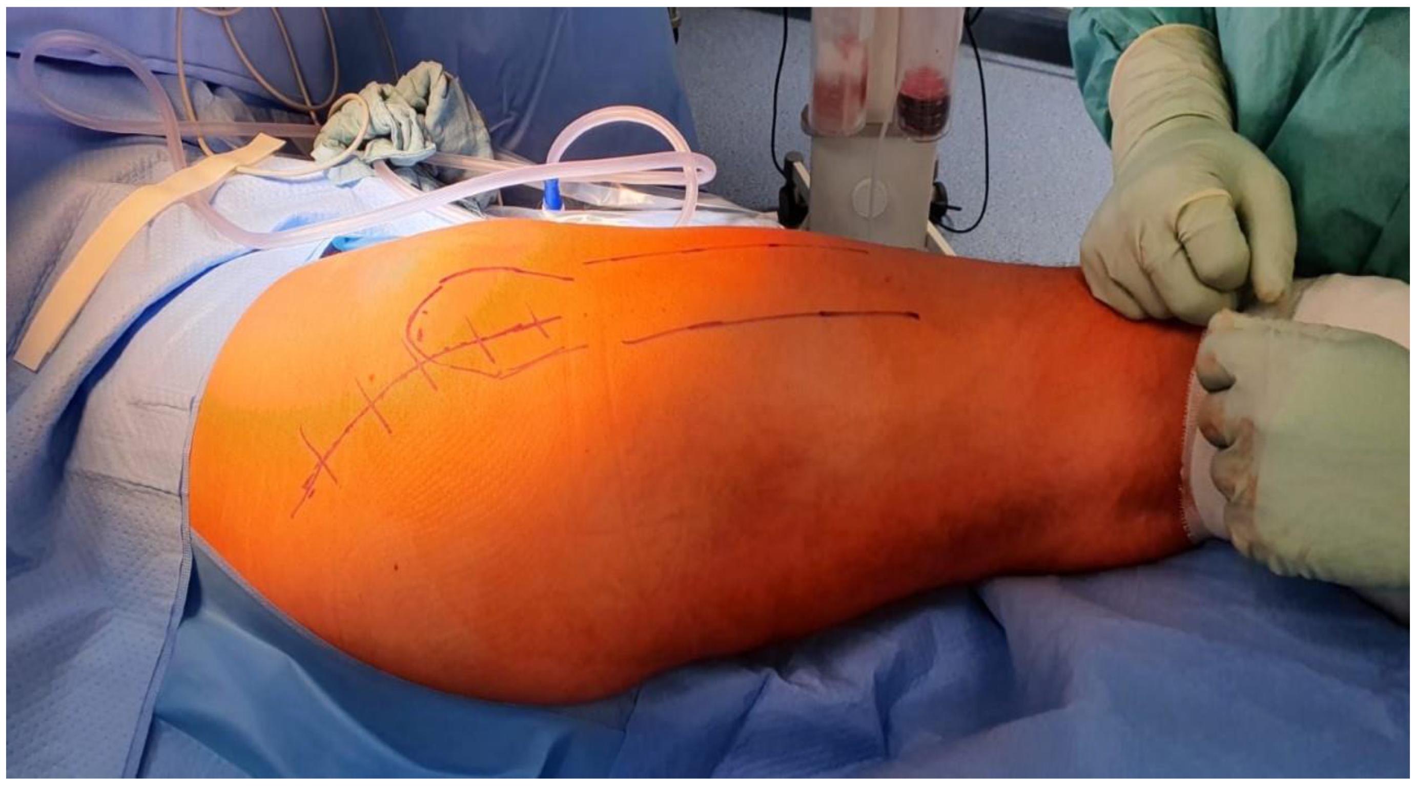 Traumacare 02 00038 g003 550