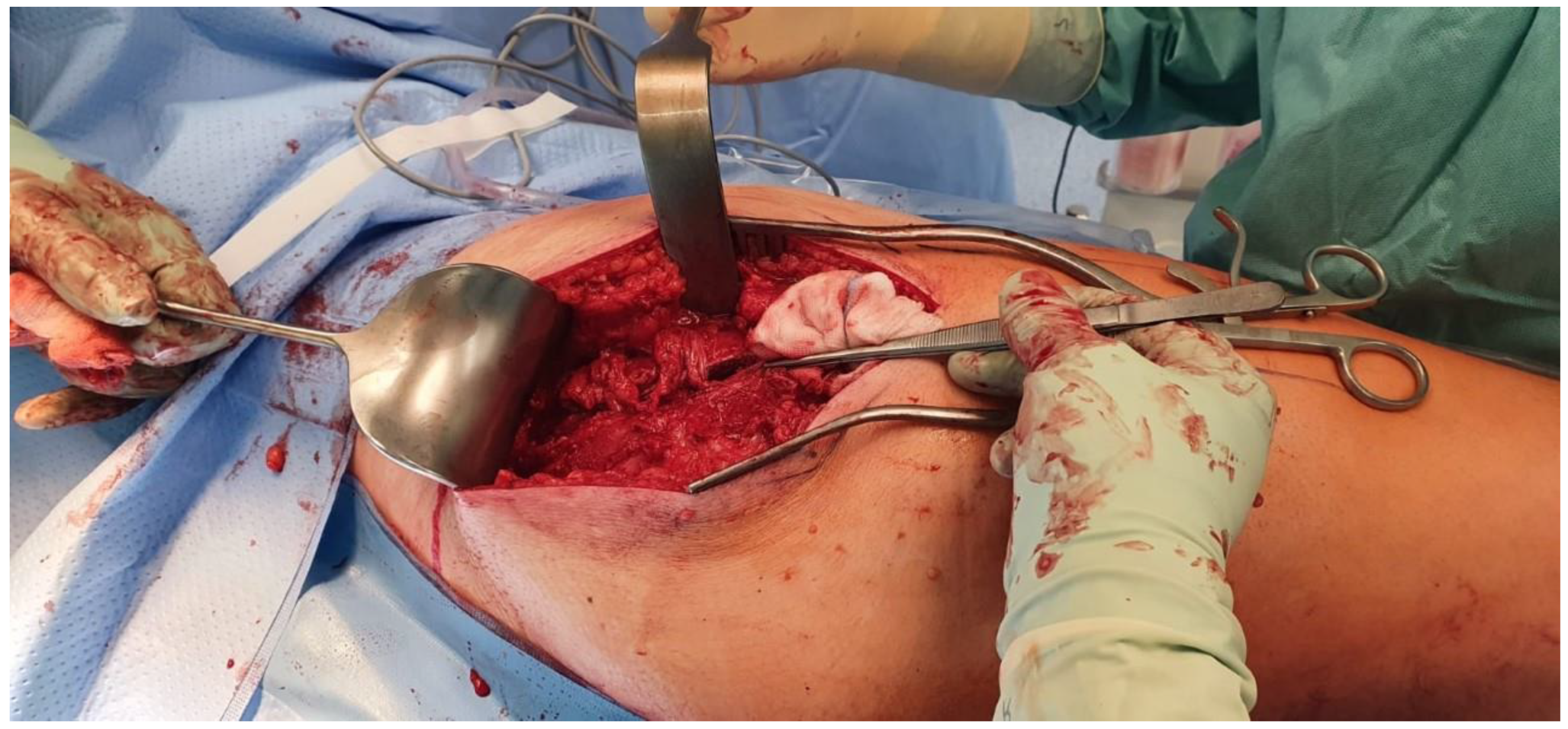 Traumacare 02 00038 g004 550